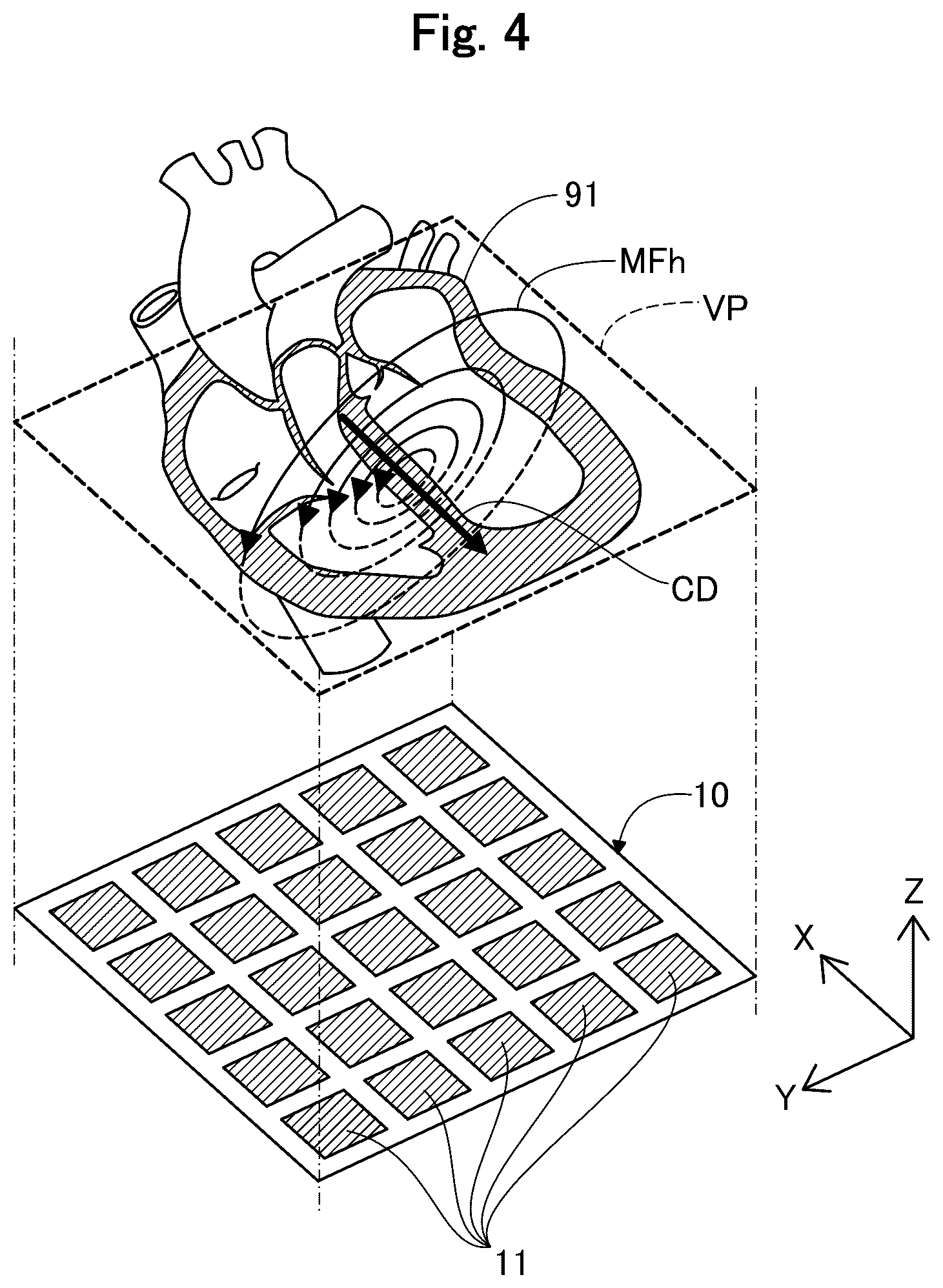 Patent US12564345 Figure 4 – Medical apparatus, and image generation method for visualizing temporal trends of biomagnetic data on an organ model