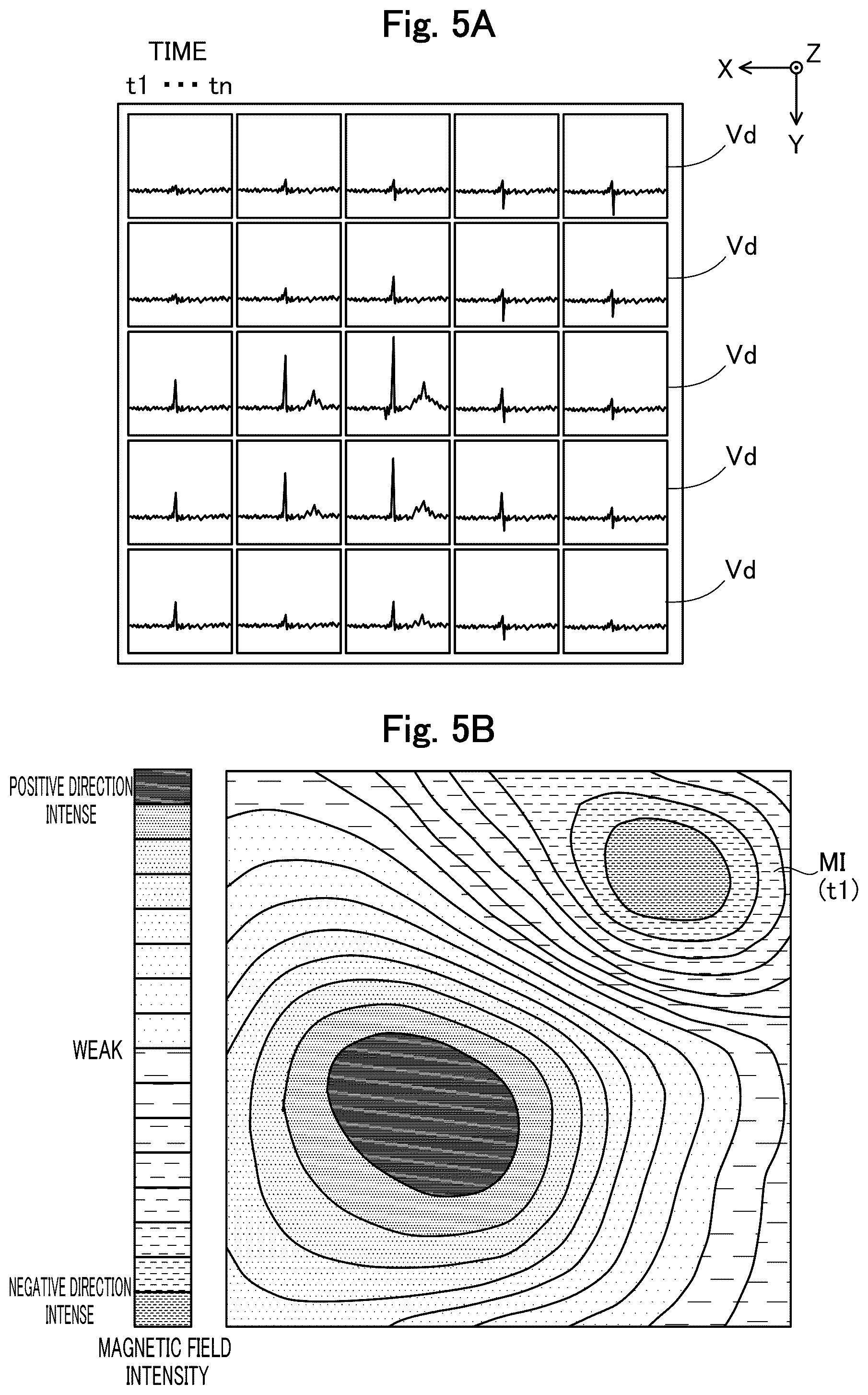 Patent US12564345 Figure 5 – Medical apparatus, and image generation method for visualizing temporal trends of biomagnetic data on an organ model
