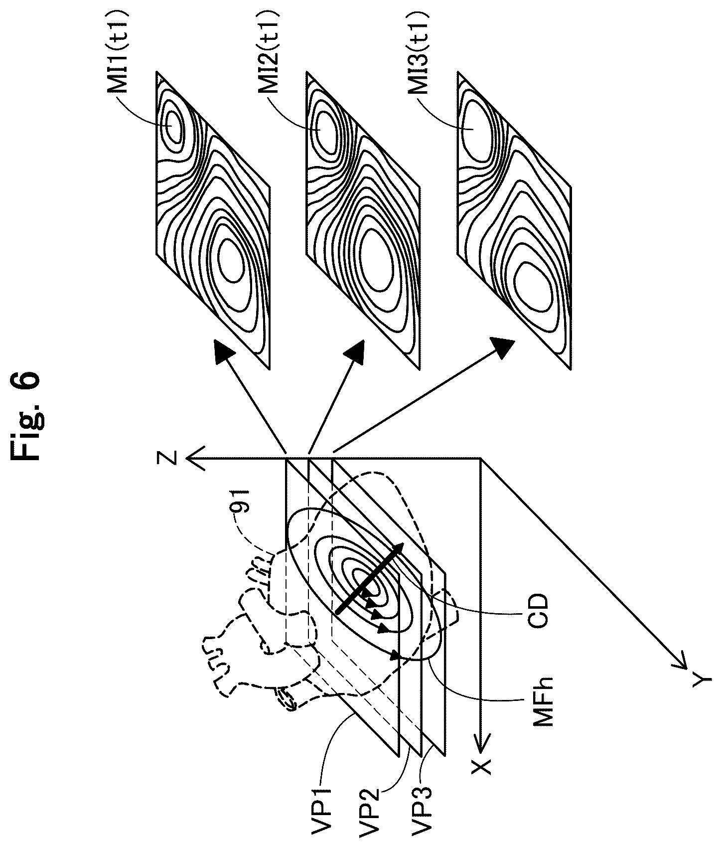 Patent US12564345 Figure 6 – Medical apparatus, and image generation method for visualizing temporal trends of biomagnetic data on an organ model