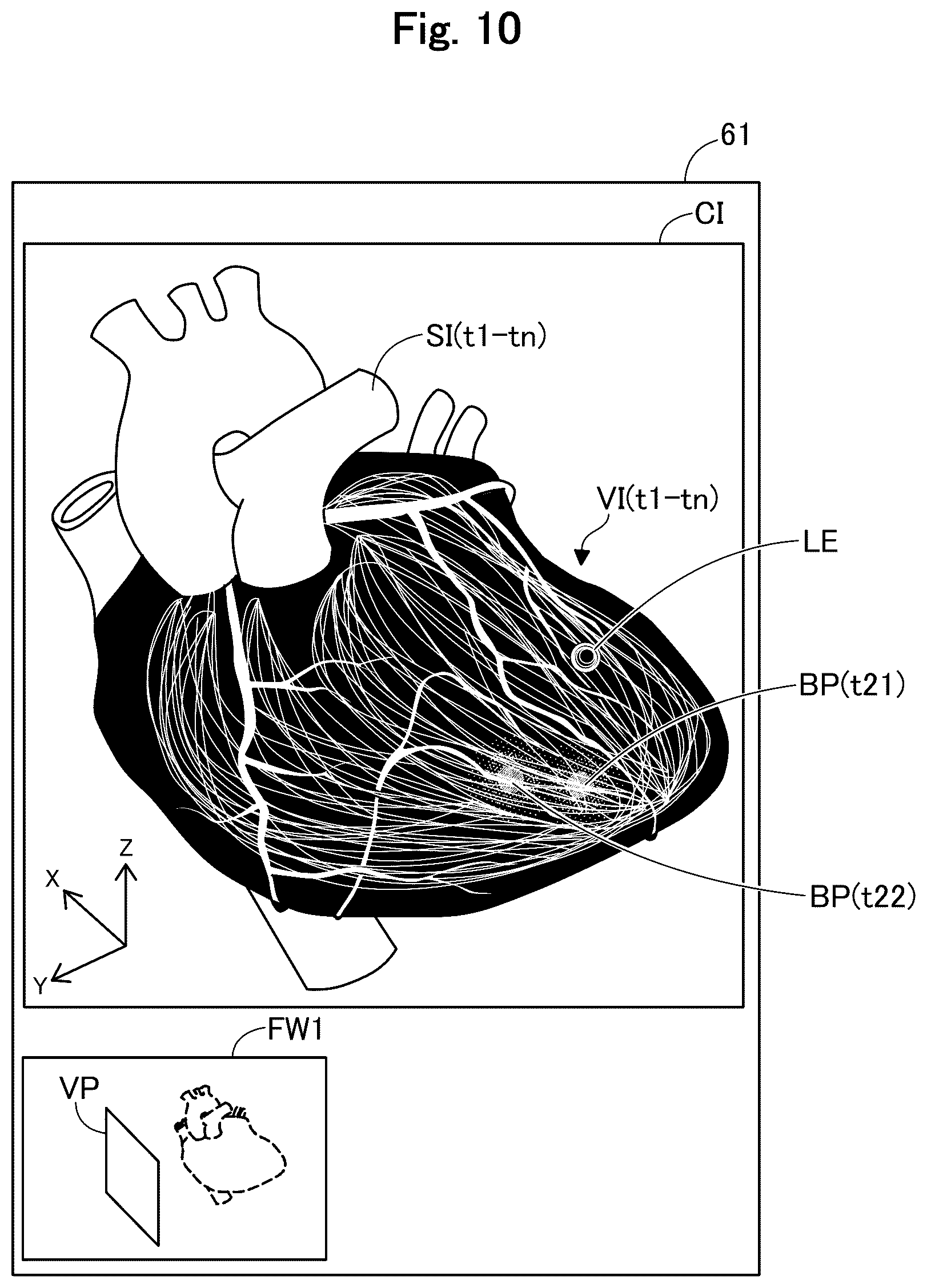 Patent US12564345 Figure 10 – Medical apparatus, and image generation method for visualizing temporal trends of biomagnetic data on an organ model