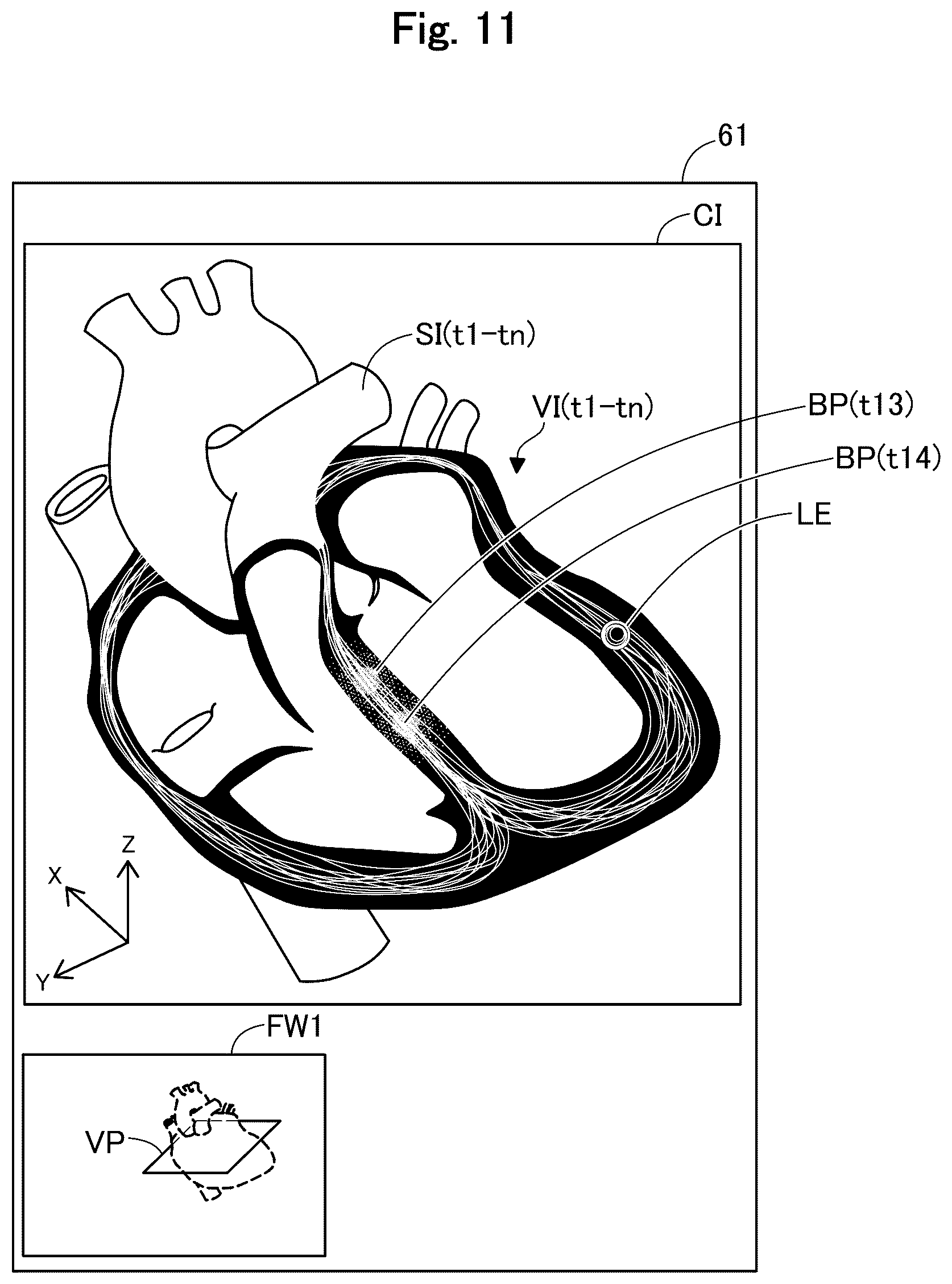 Patent US12564345 Figure 11 – Medical apparatus, and image generation method for visualizing temporal trends of biomagnetic data on an organ model