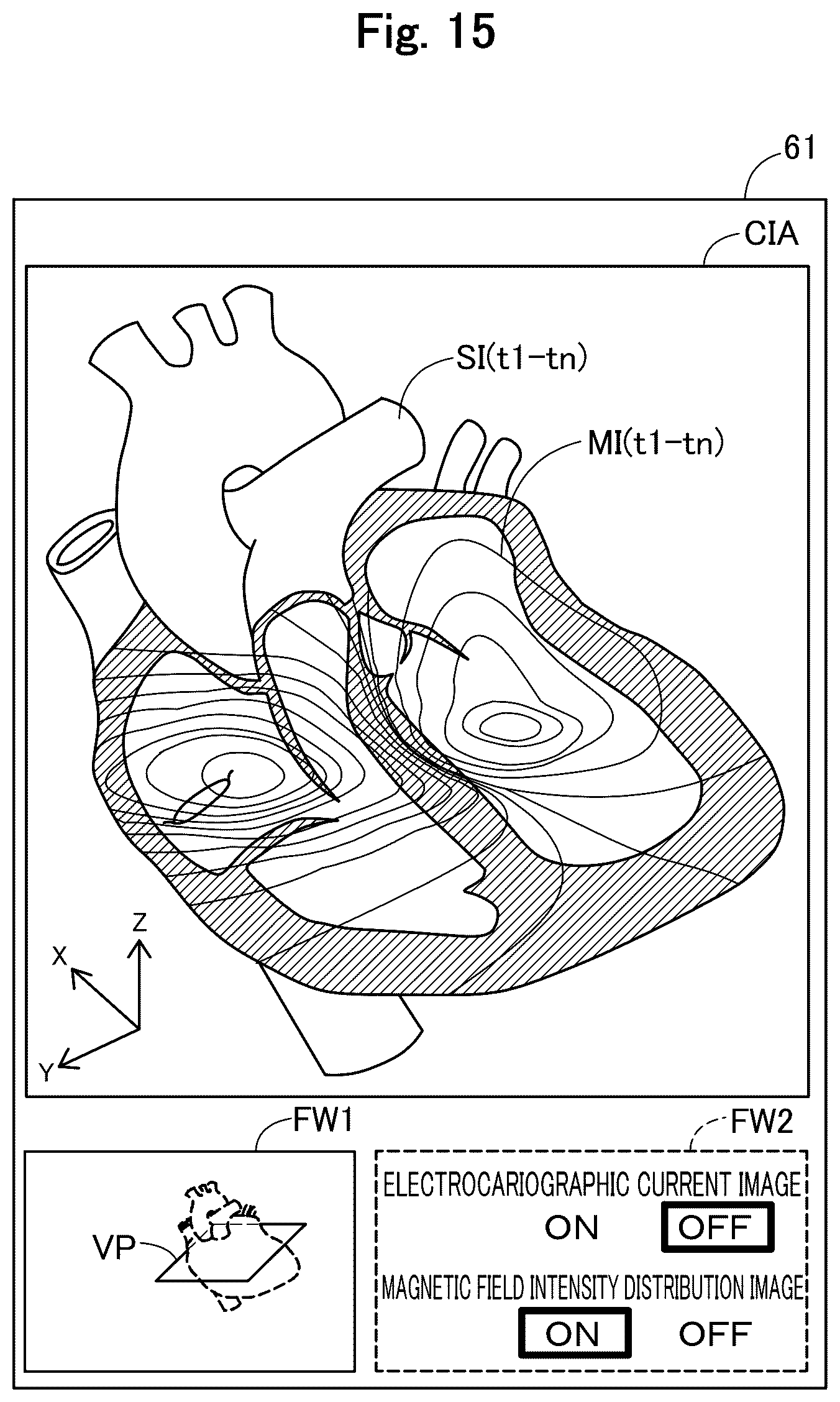 Patent US12564345 Figure 15 – Medical apparatus, and image generation method for visualizing temporal trends of biomagnetic data on an organ model