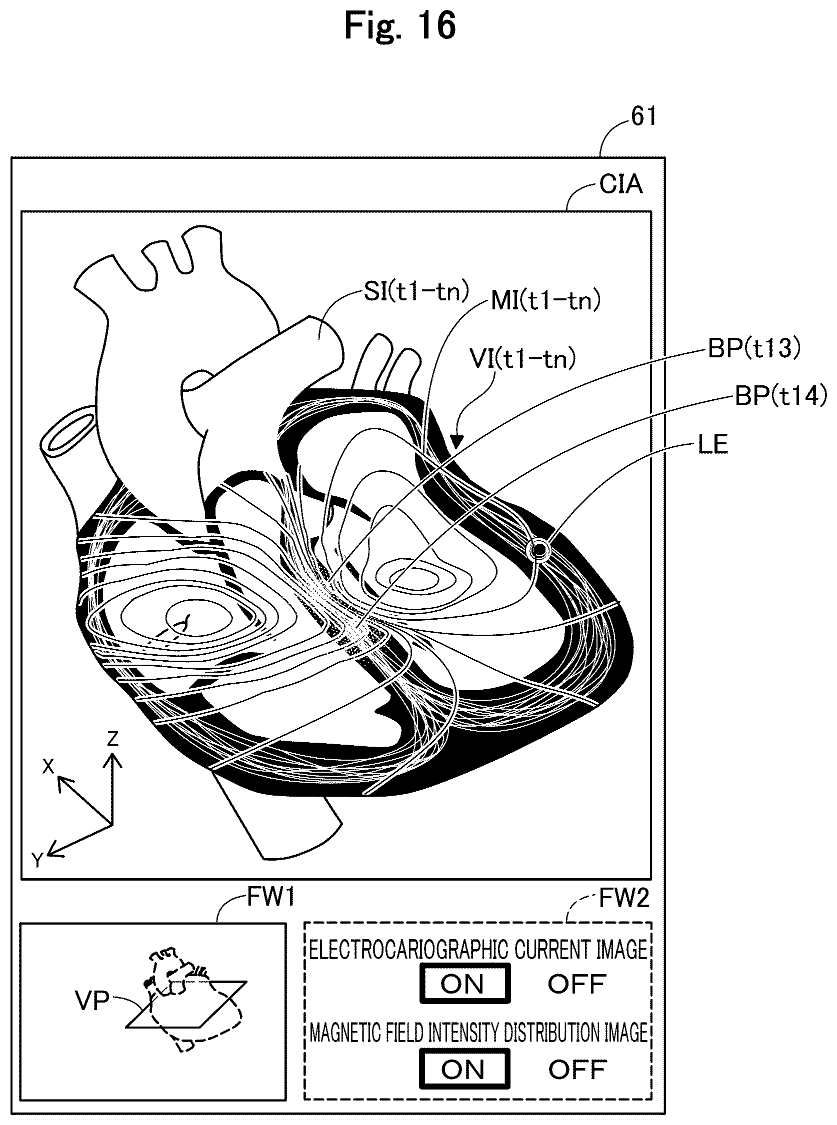 Patent US12564345 Figure 16 – Medical apparatus, and image generation method for visualizing temporal trends of biomagnetic data on an organ model
