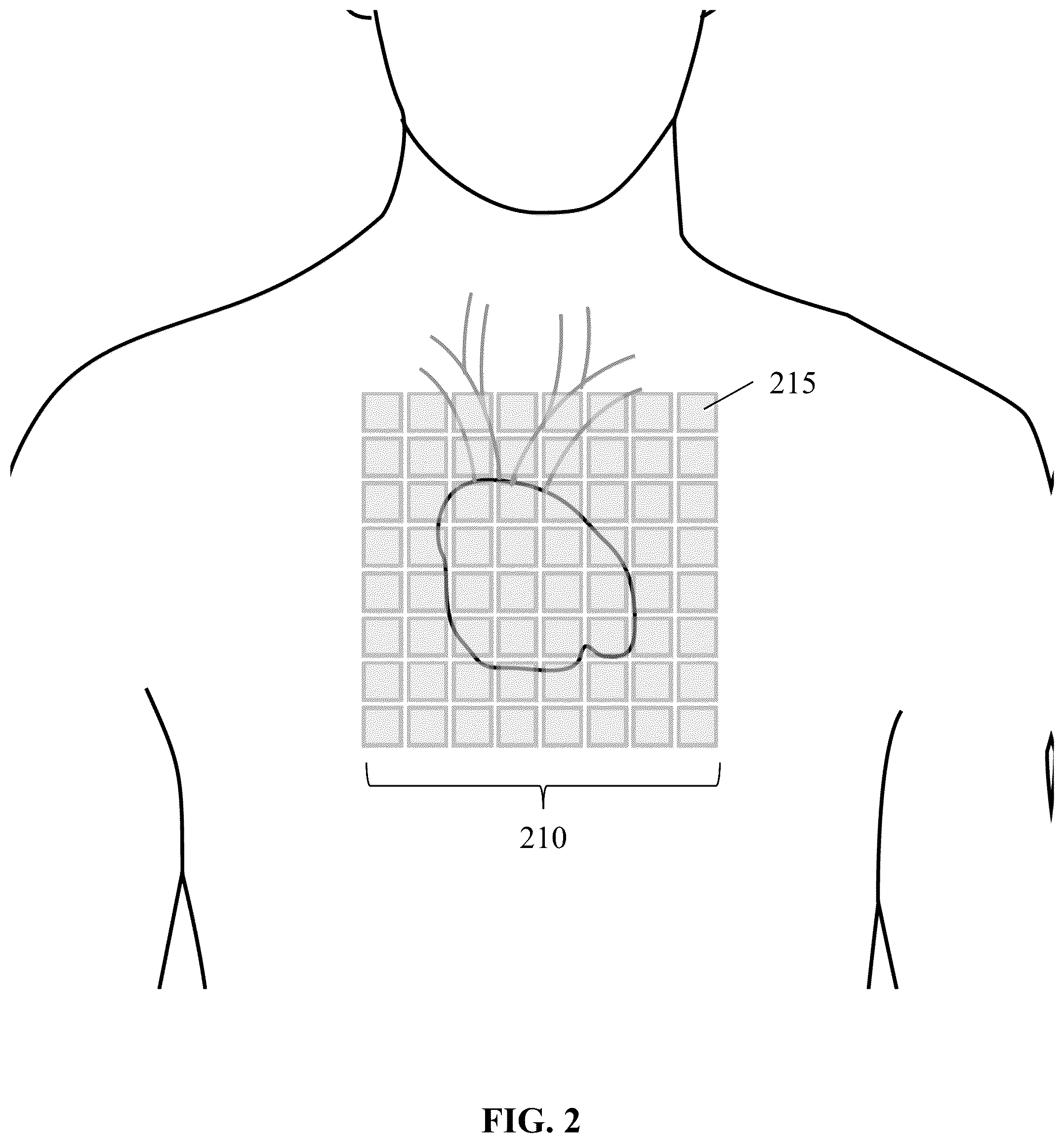 Patent US12564346 Figure 2 – Unshielded pulsed pump magnetometers for biomagnetic measurements