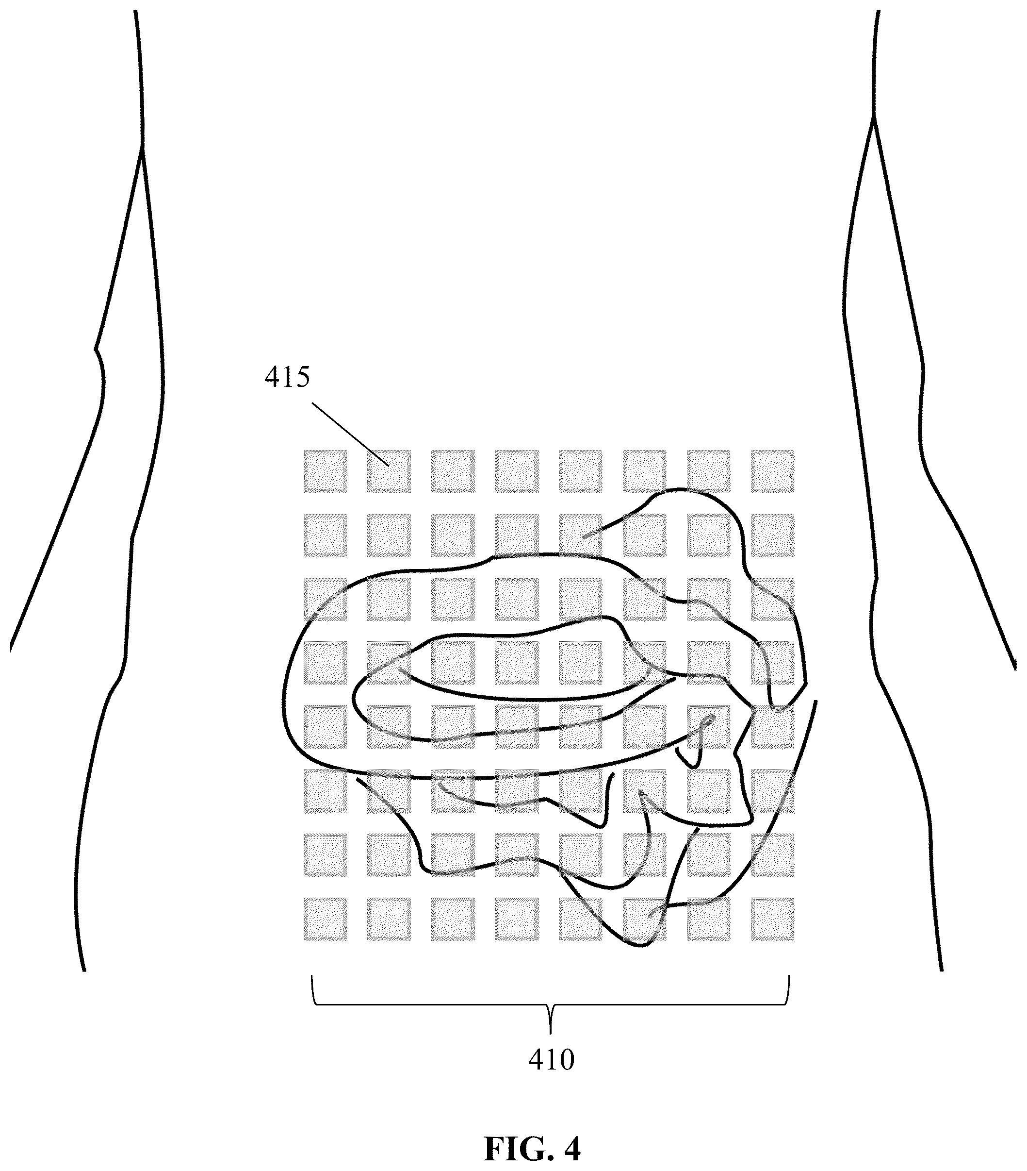 Patent US12564346 Figure 4 – Unshielded pulsed pump magnetometers for biomagnetic measurements
