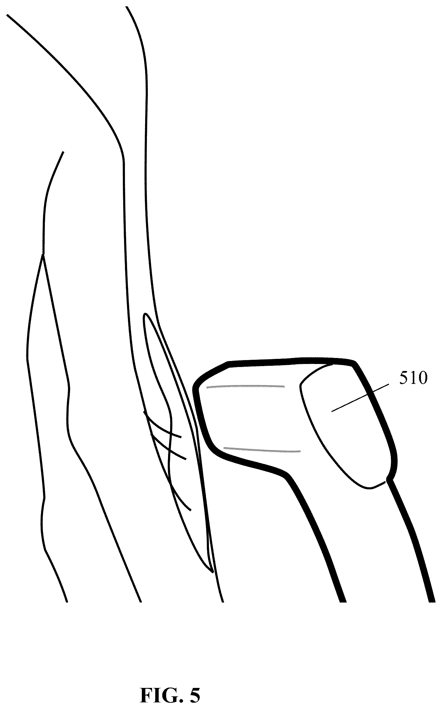 Patent US12564346 Figure 5 – Unshielded pulsed pump magnetometers for biomagnetic measurements