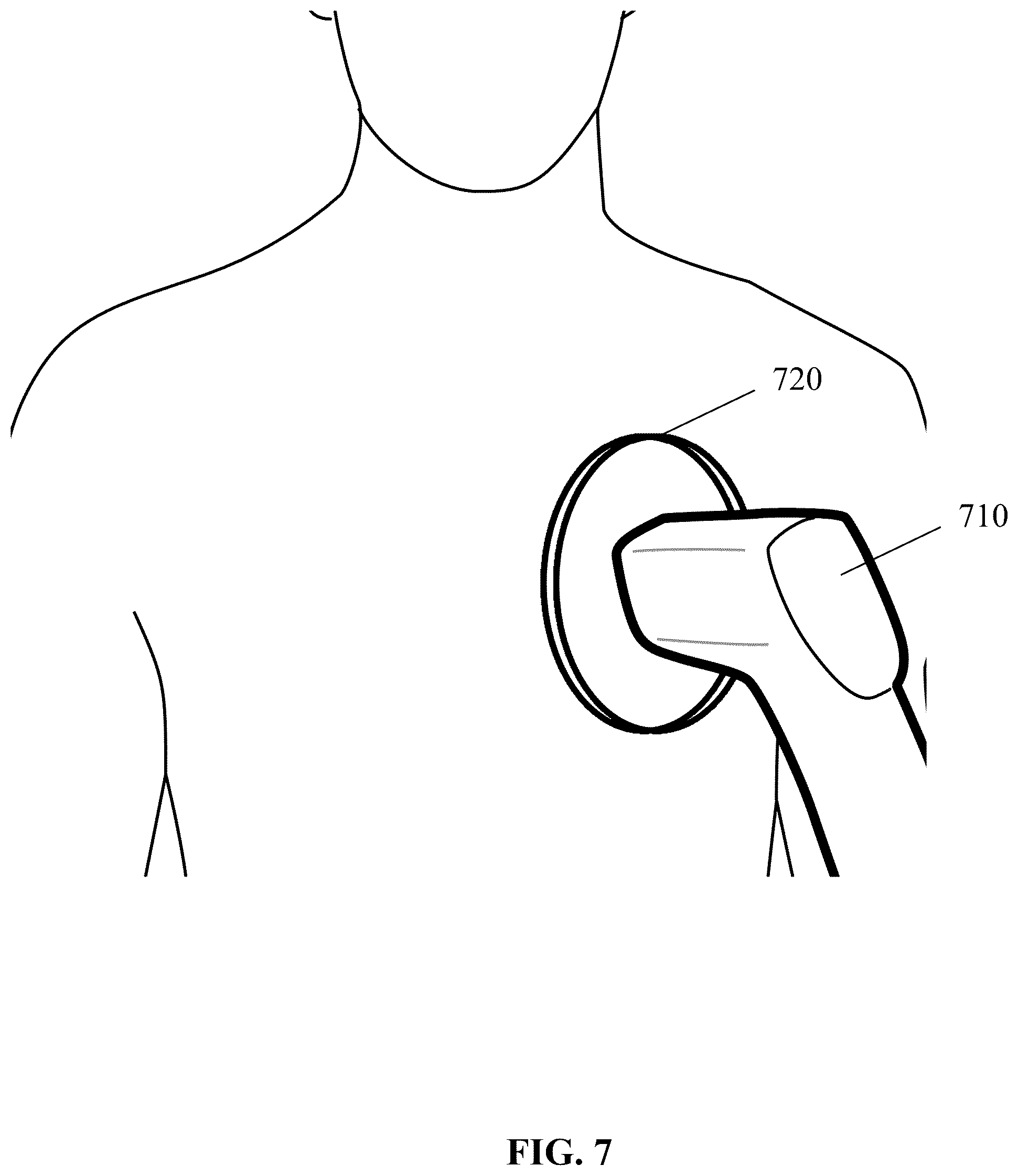 Patent US12564346 Figure 7 – Unshielded pulsed pump magnetometers for biomagnetic measurements