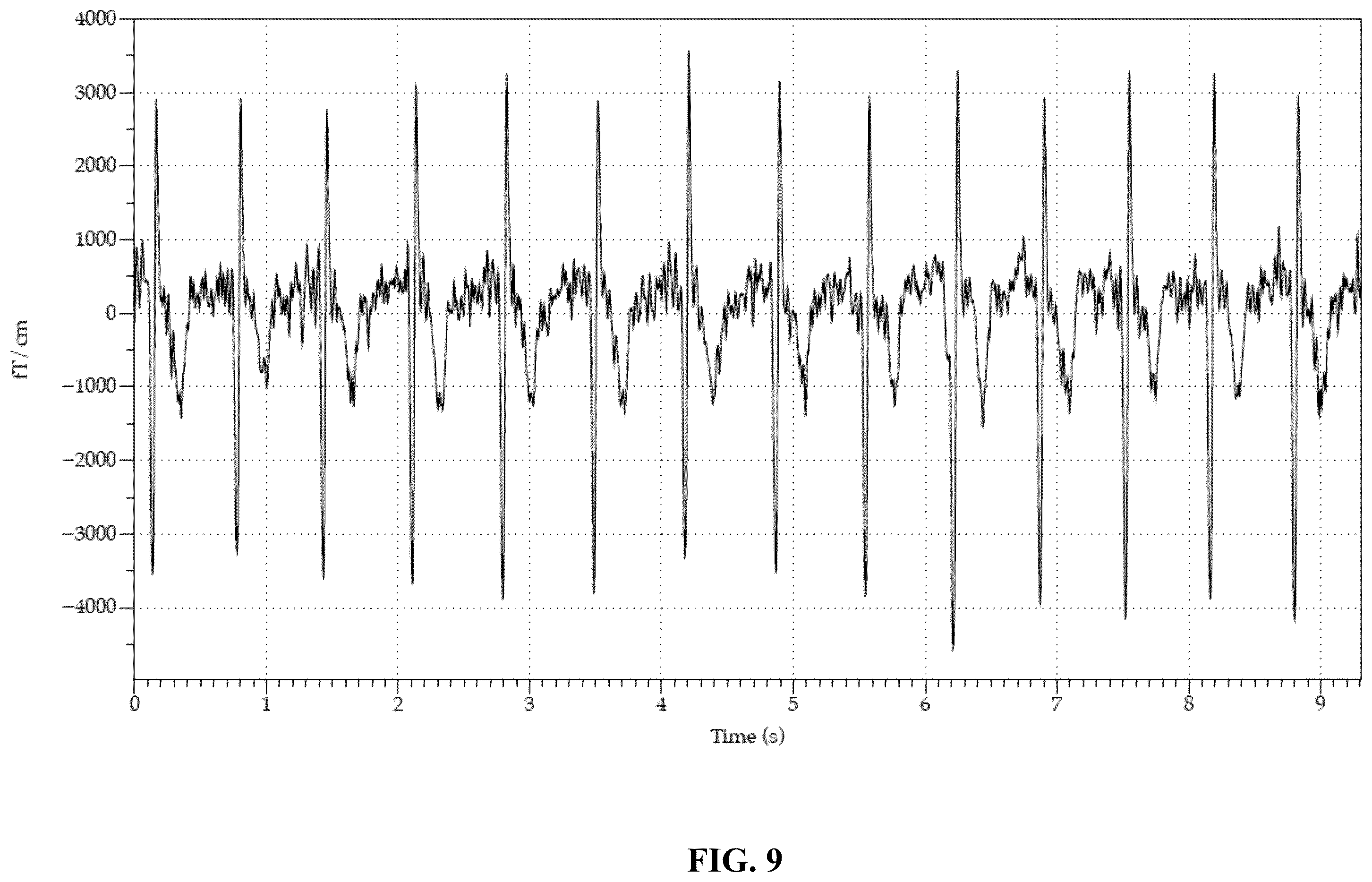 Patent US12564346 Figure 9 – Unshielded pulsed pump magnetometers for biomagnetic measurements