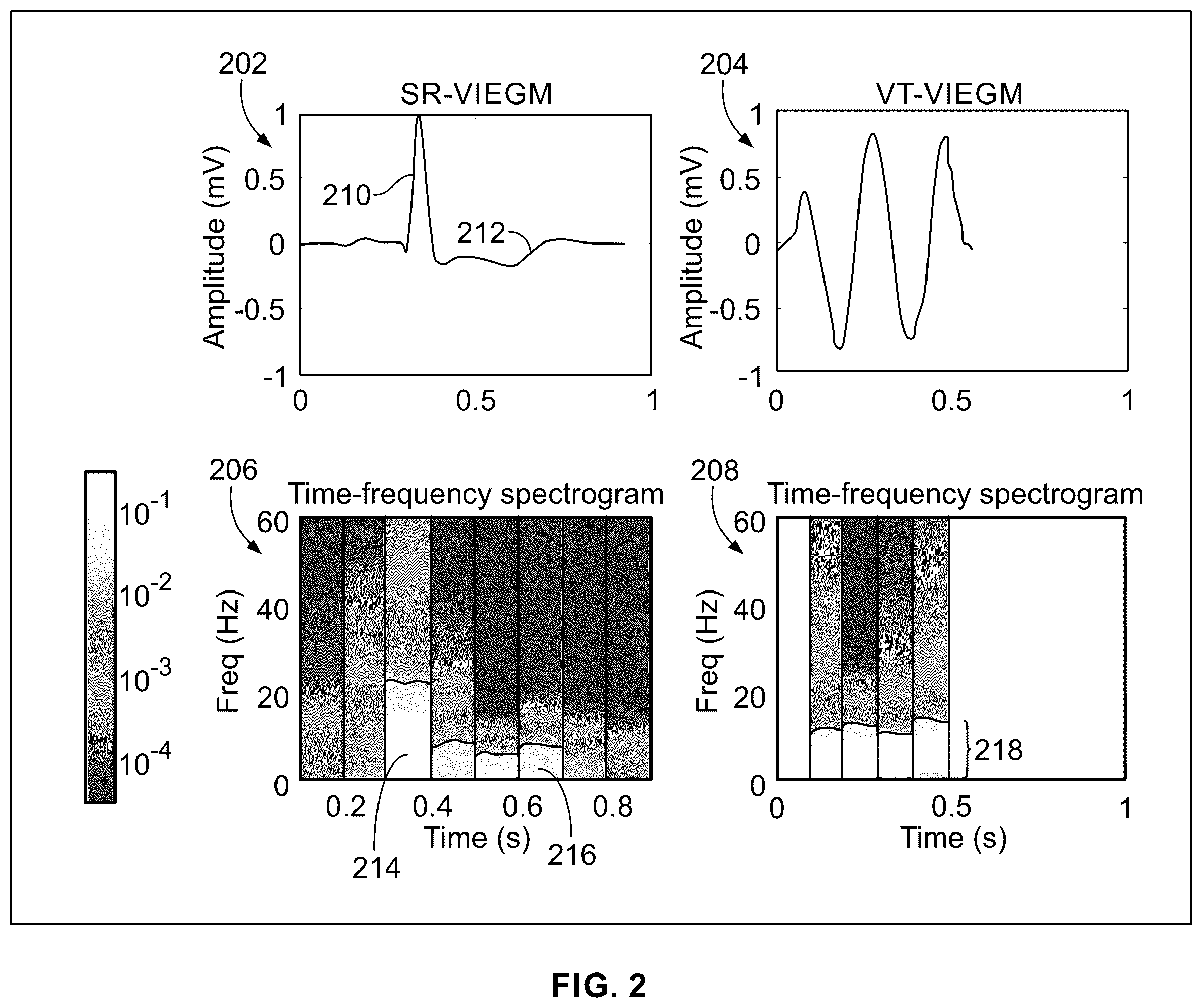 Patent US12564348 Figure 2 – Device and method for detecting ventricular arrhythmias based on duty cycle characteristics