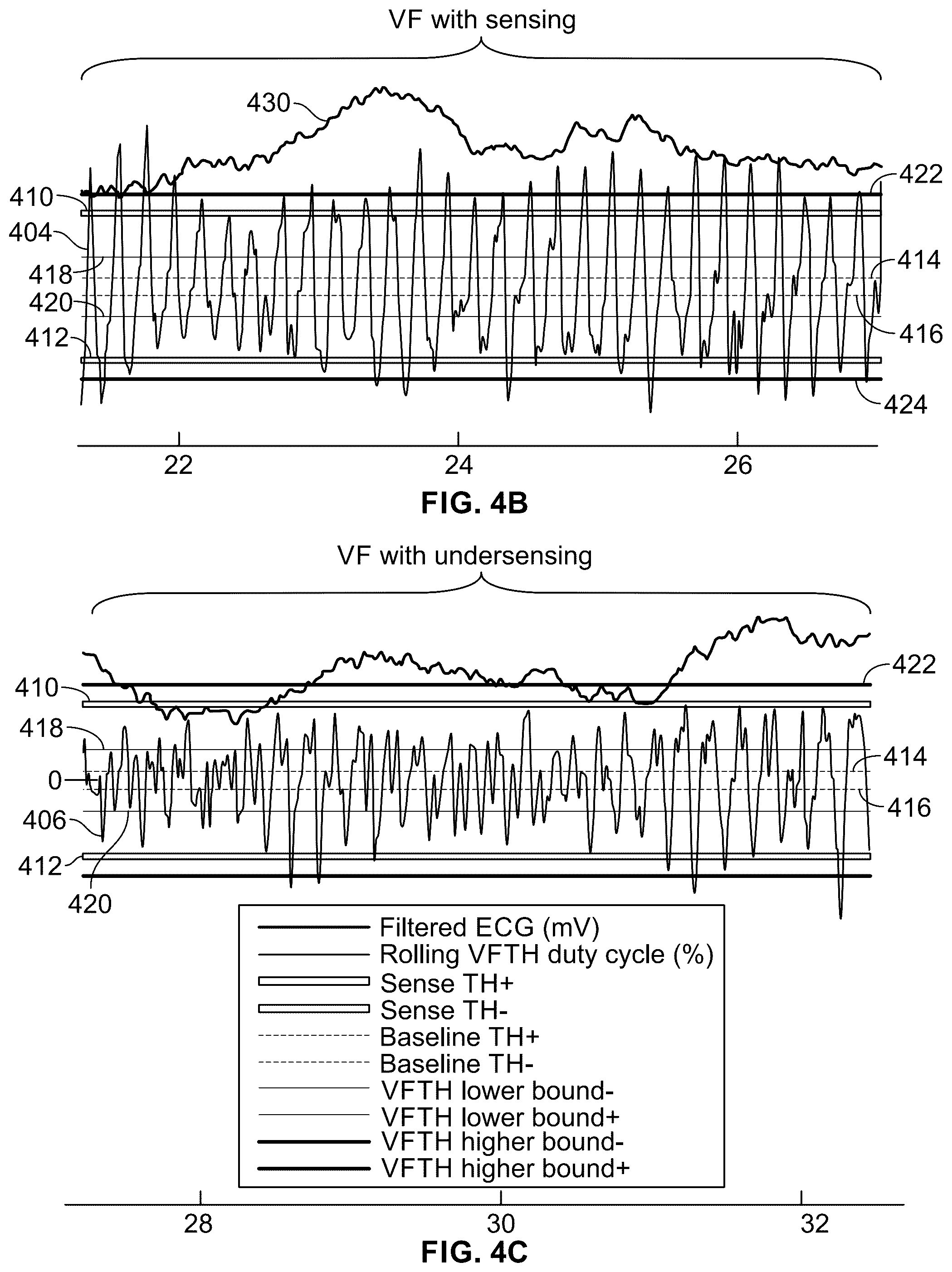 Patent US12564348 Figure 5 – Device and method for detecting ventricular arrhythmias based on duty cycle characteristics