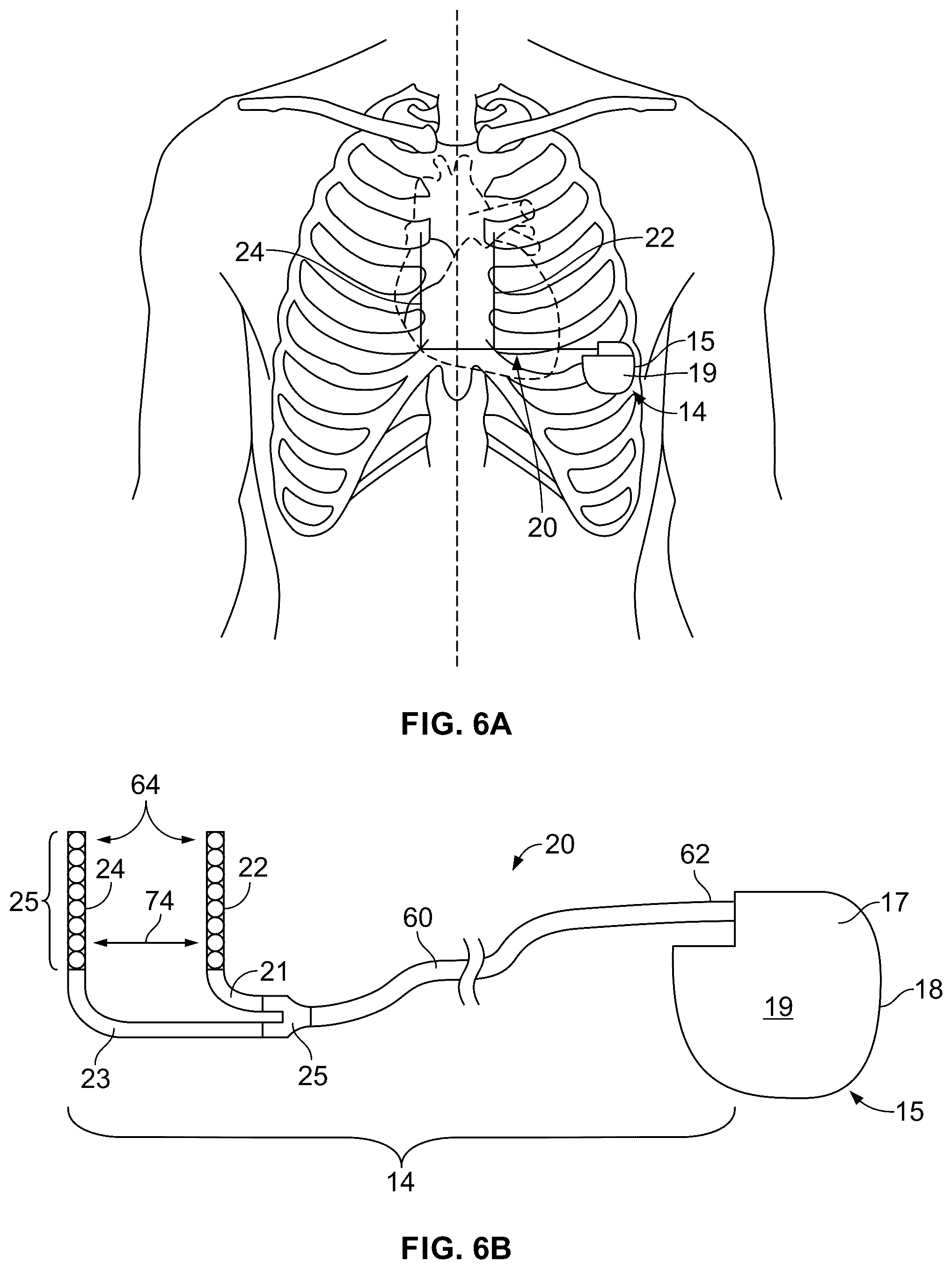 Patent US12564348 Figure 8 – Device and method for detecting ventricular arrhythmias based on duty cycle characteristics