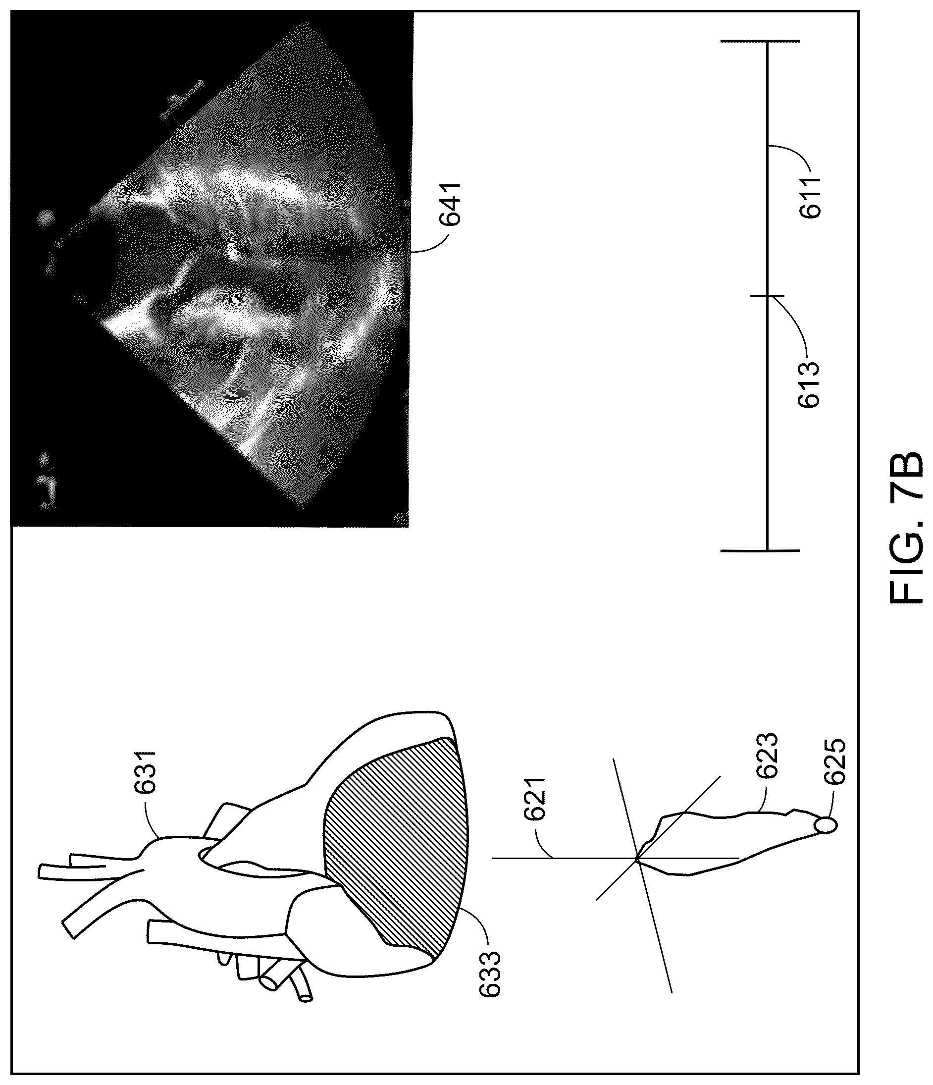 Patent US12564349 Figure 11 – Systems for comparative analysis of cardiac information