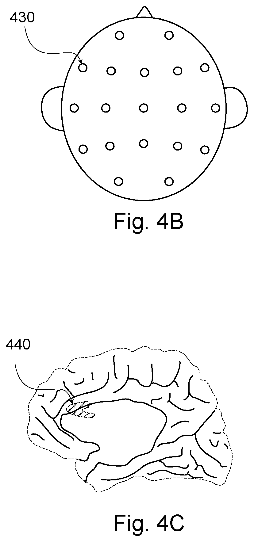 Patent US12564350 Figure 6 – Methods and systems for therapeutic neuromodulation