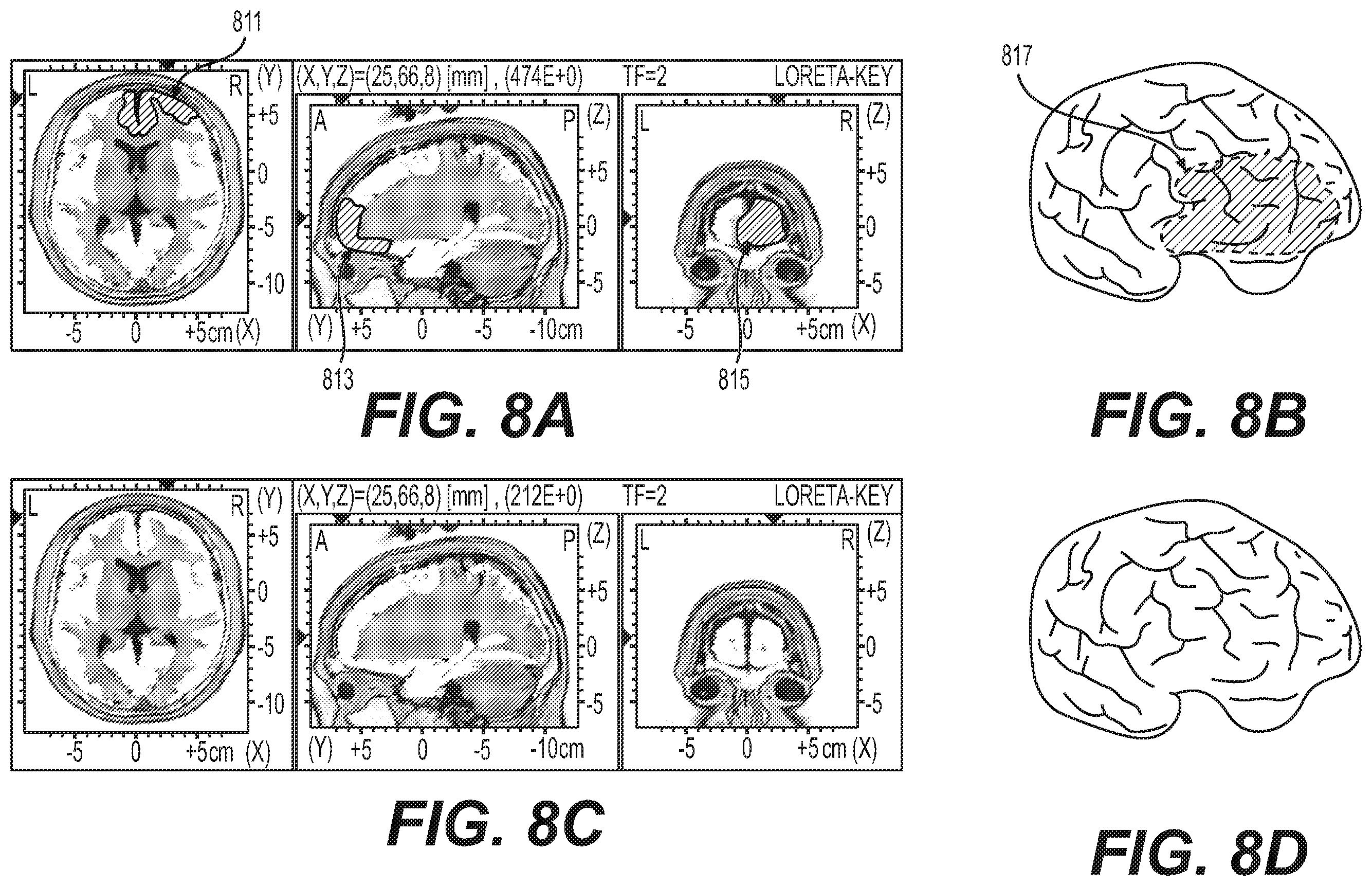 Patent US12564350 Figure 11 – Methods and systems for therapeutic neuromodulation