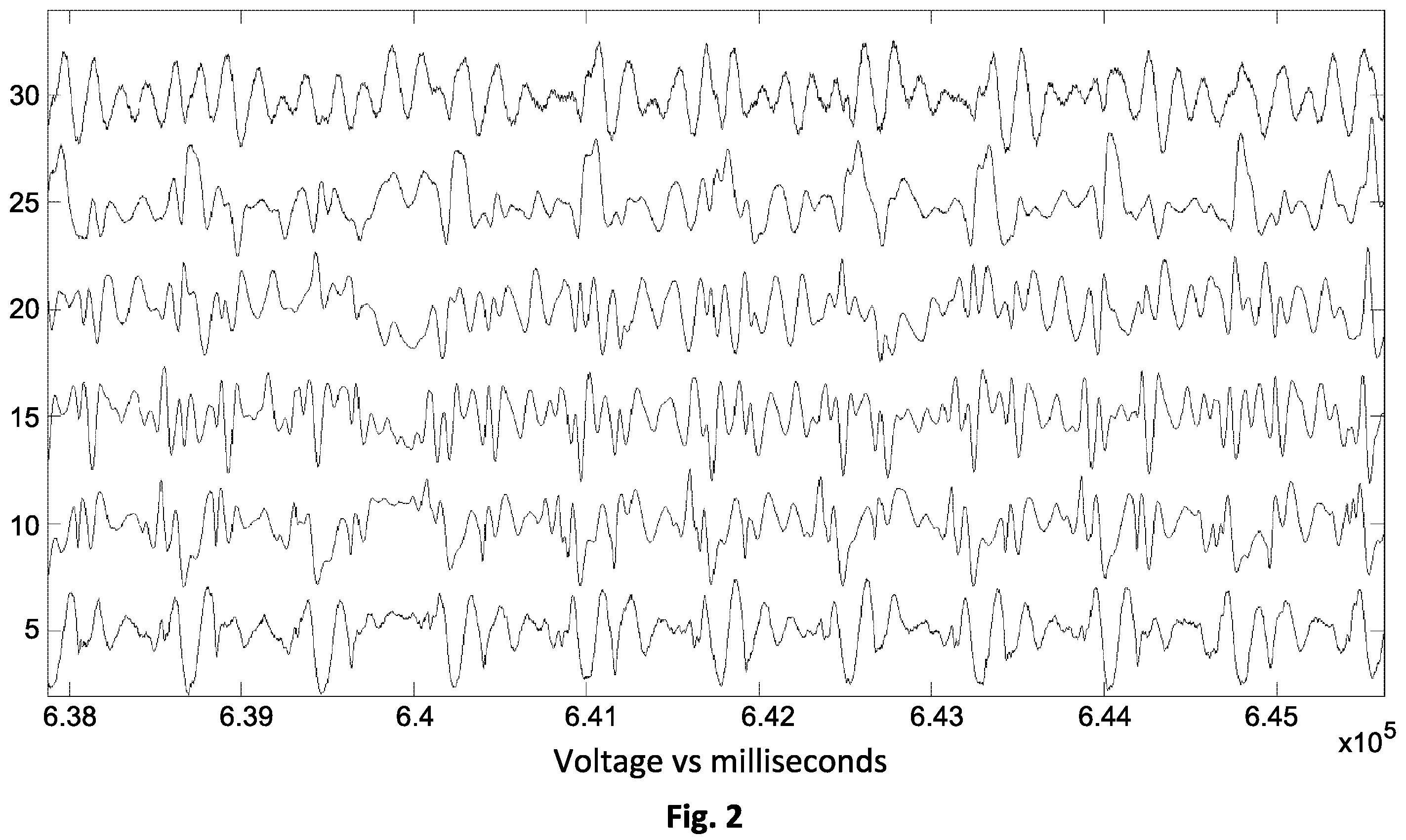 Patent US12564355 Figure 4 – Micro motion detection for determining at least one vital sign of a subject