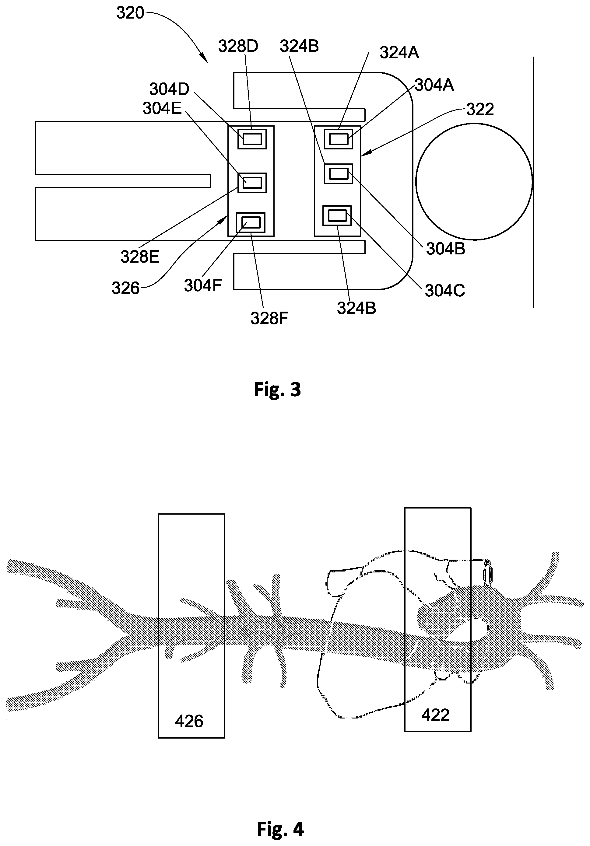 Patent US12564355 Figure 5 – Micro motion detection for determining at least one vital sign of a subject