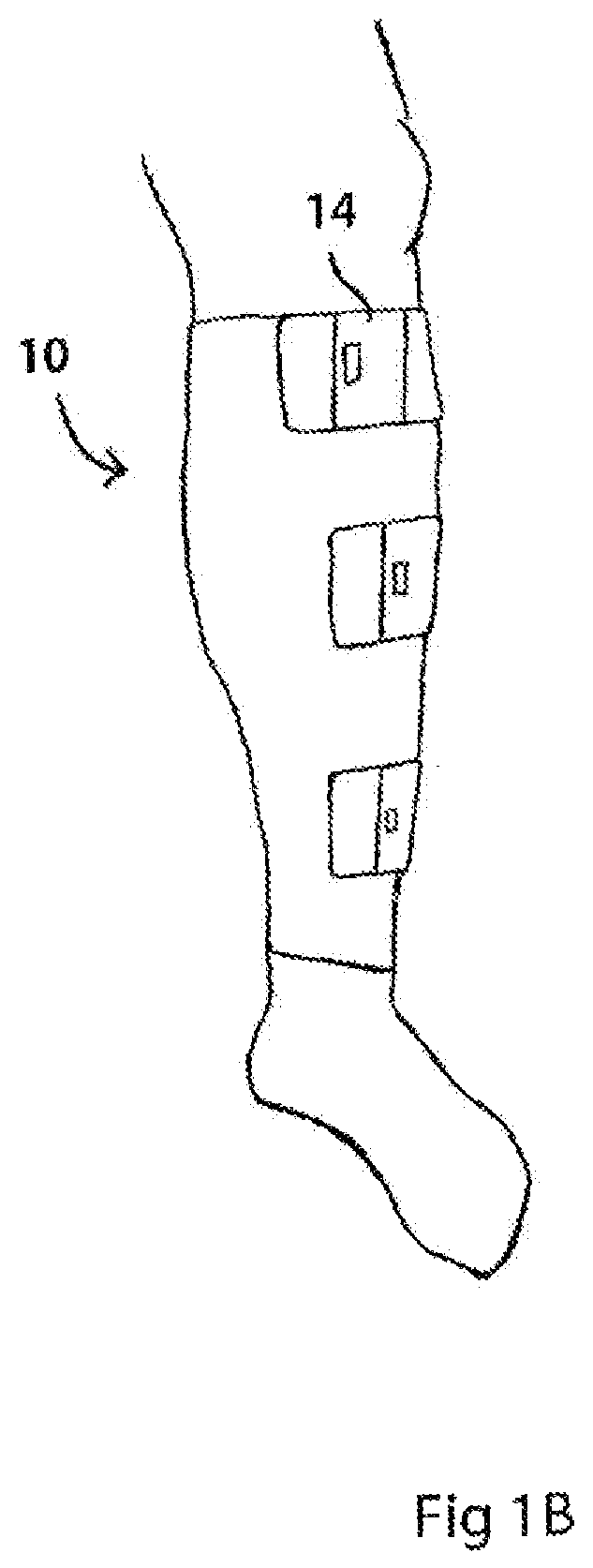 Patent US12564356 Figure 2 – Two-layer tension measurement system for compression garments