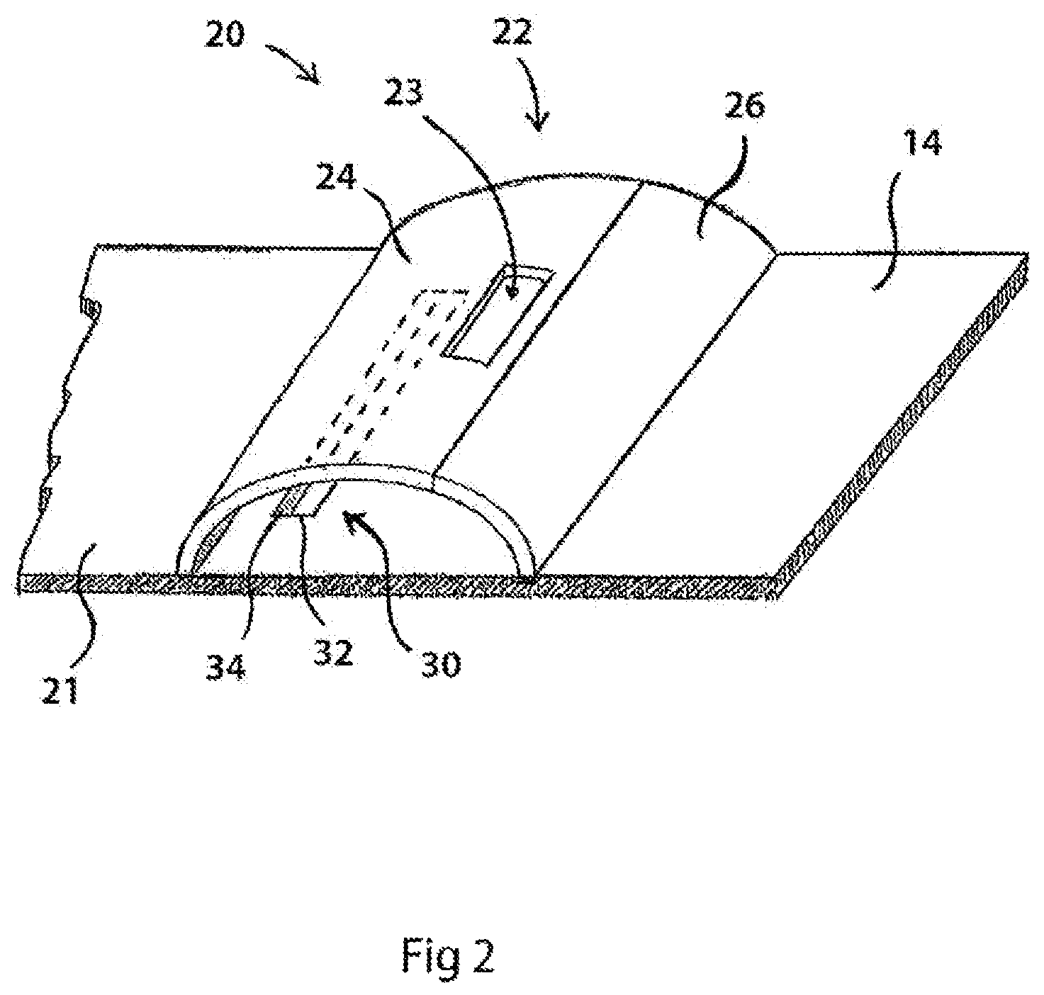 Patent US12564356 Figure 3 – Two-layer tension measurement system for compression garments