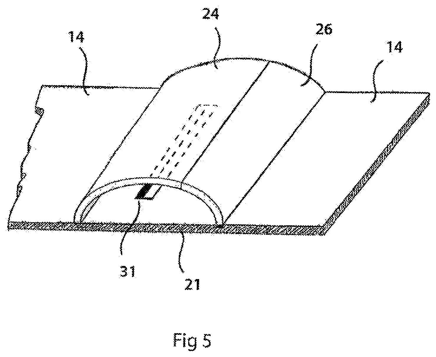 Patent US12564356 Figure 6 – Two-layer tension measurement system for compression garments