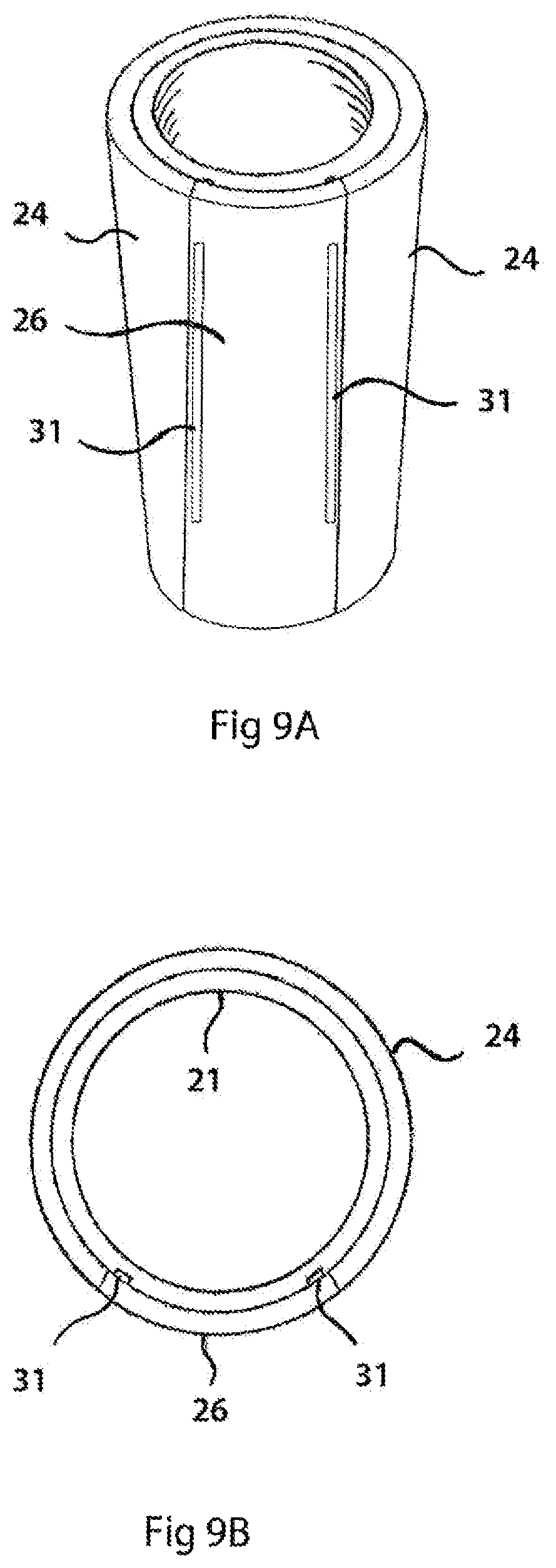 Patent US12564356 Figure 10 – Two-layer tension measurement system for compression garments