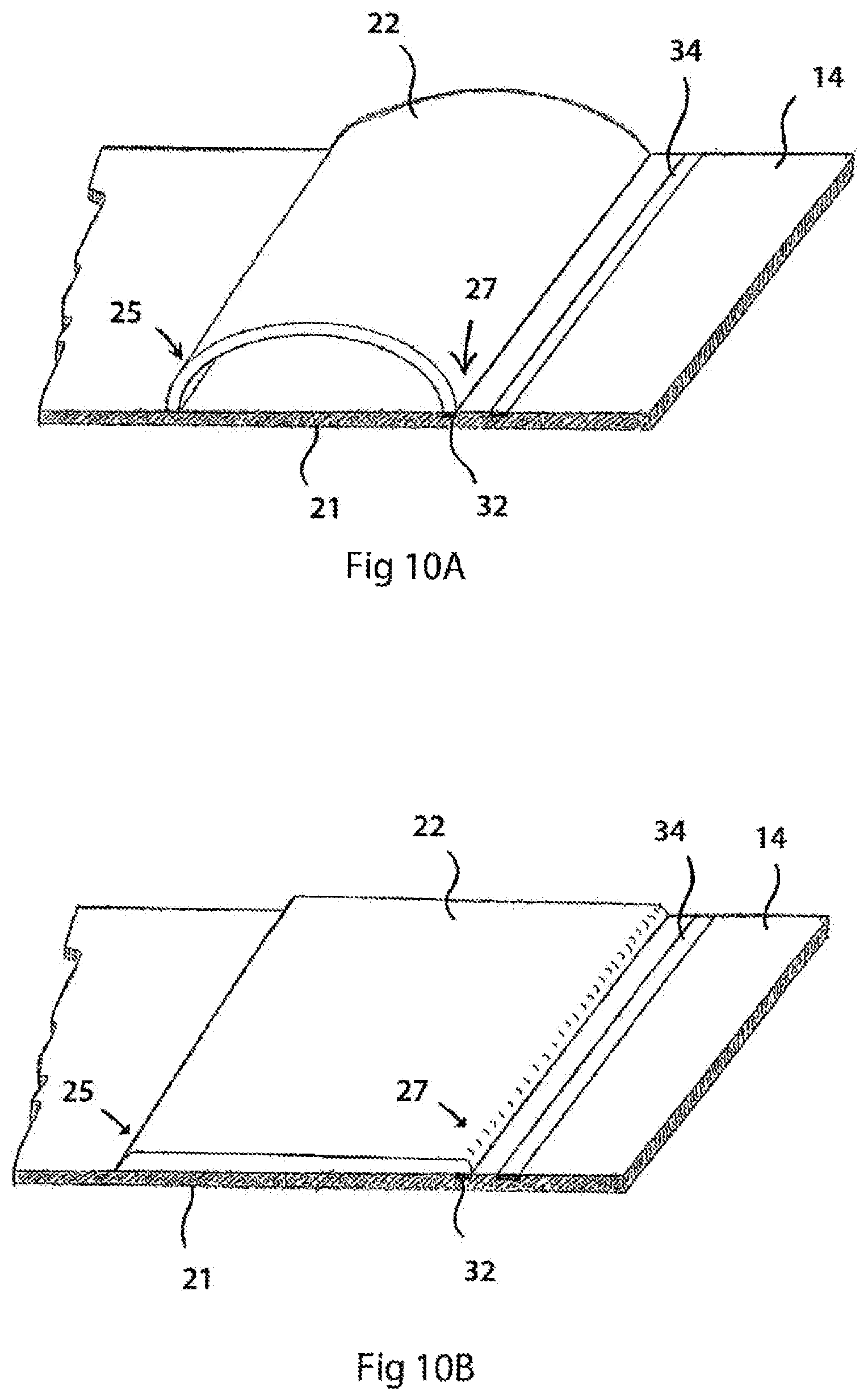 Patent US12564356 Figure 11 – Two-layer tension measurement system for compression garments