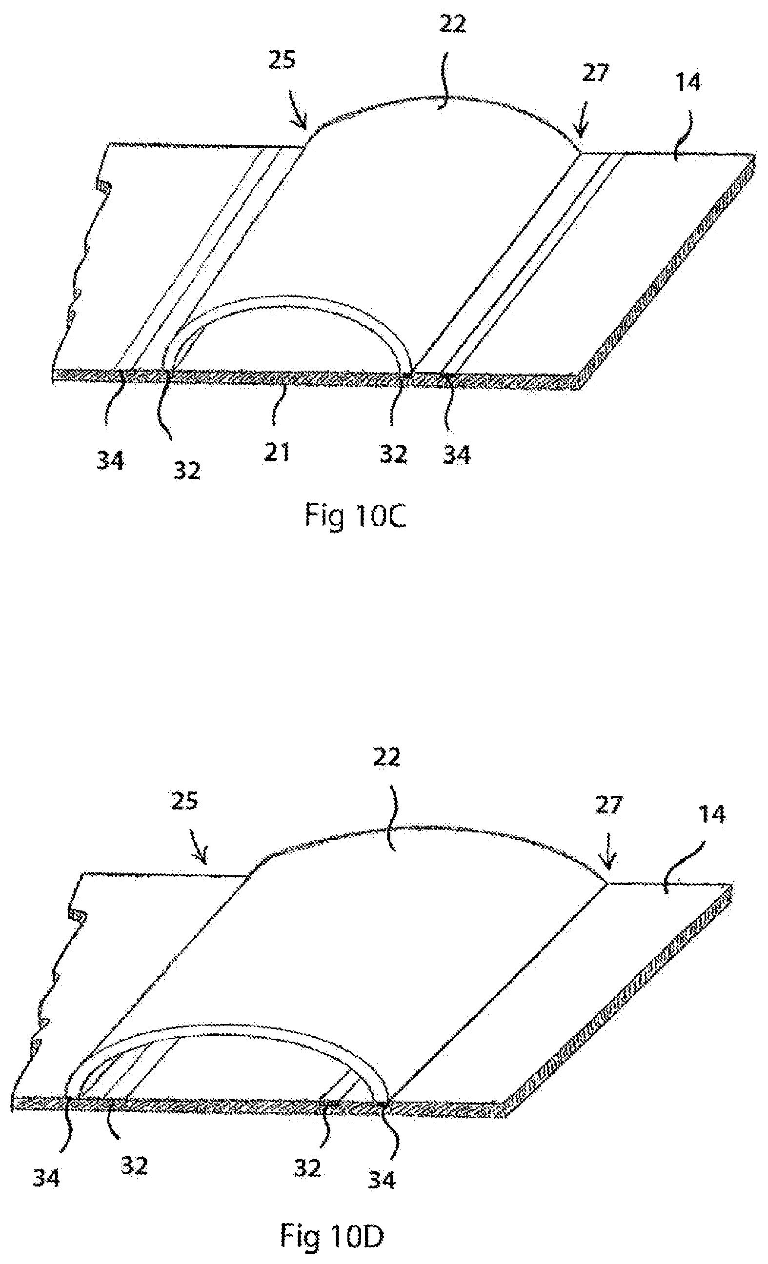 Patent US12564356 Figure 12 – Two-layer tension measurement system for compression garments