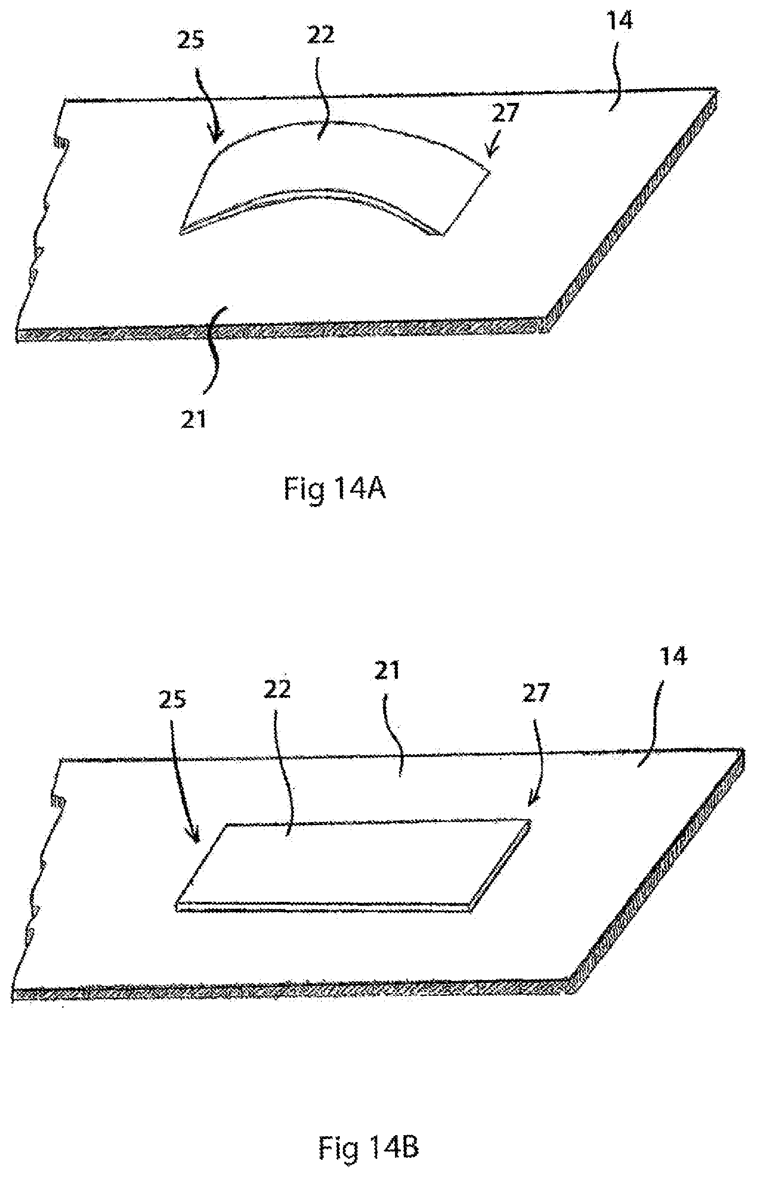 Patent US12564356 Figure 16 – Two-layer tension measurement system for compression garments