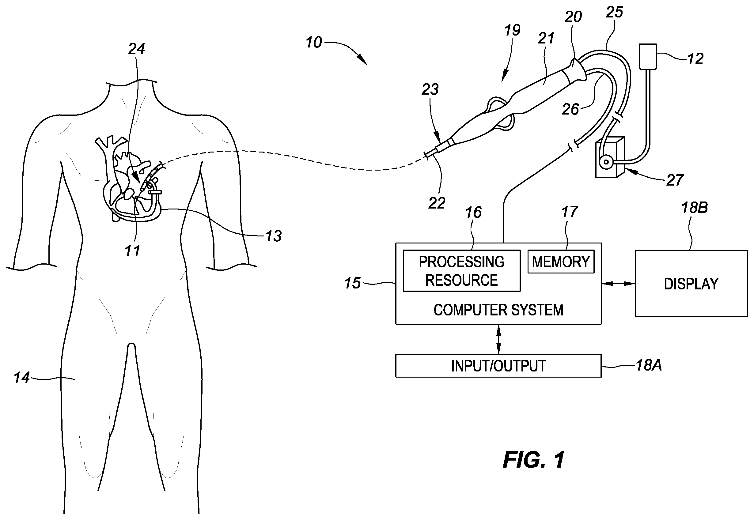Patent US12564357 Figure 1 – Force sensing catheter system