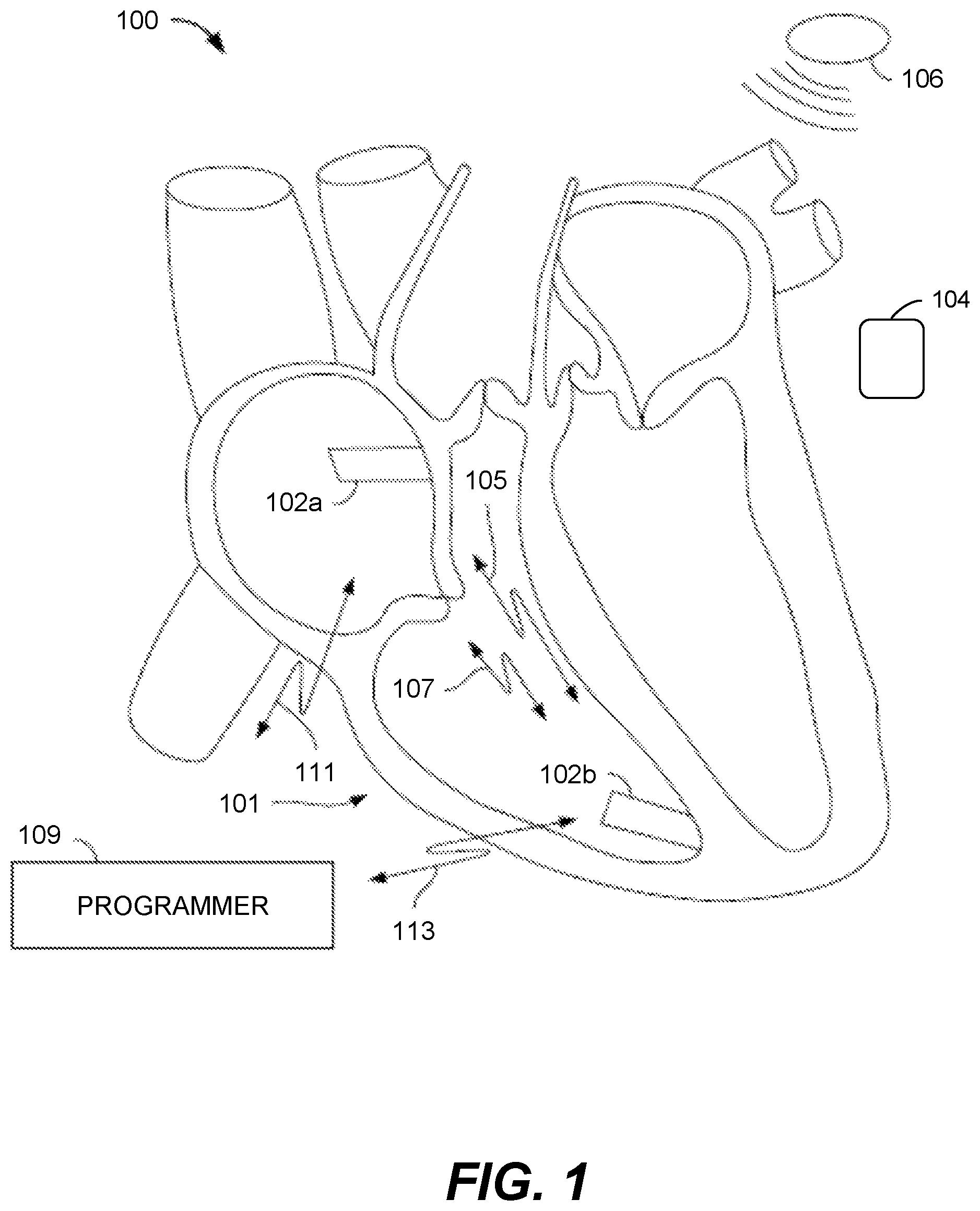 Patent US12564358 Figure 1 – Systems and methods for remote programming of, and other follow-up capabilities with, leadless pacemakers