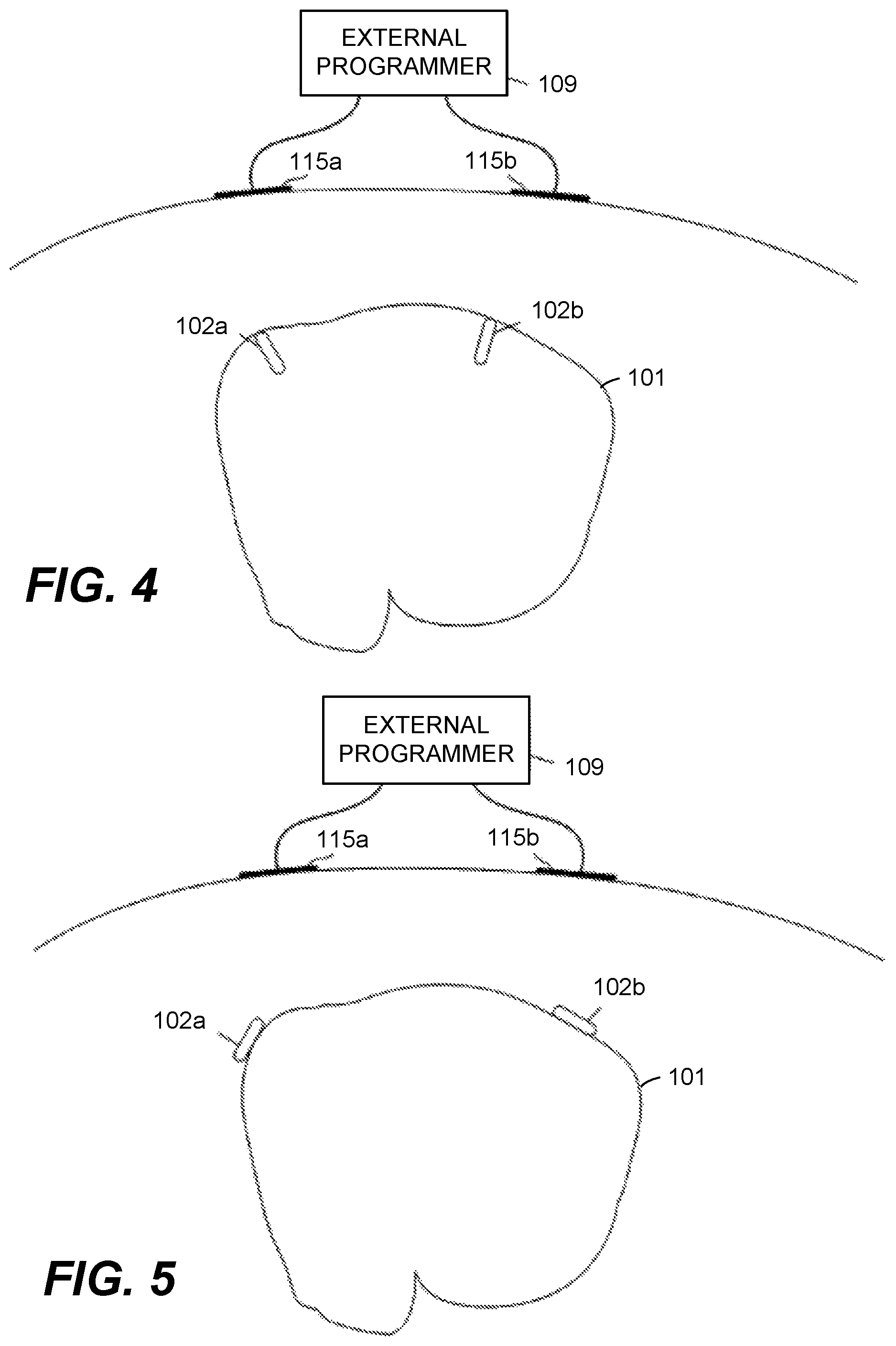 Patent US12564358 Figure 4 – Systems and methods for remote programming of, and other follow-up capabilities with, leadless pacemakers