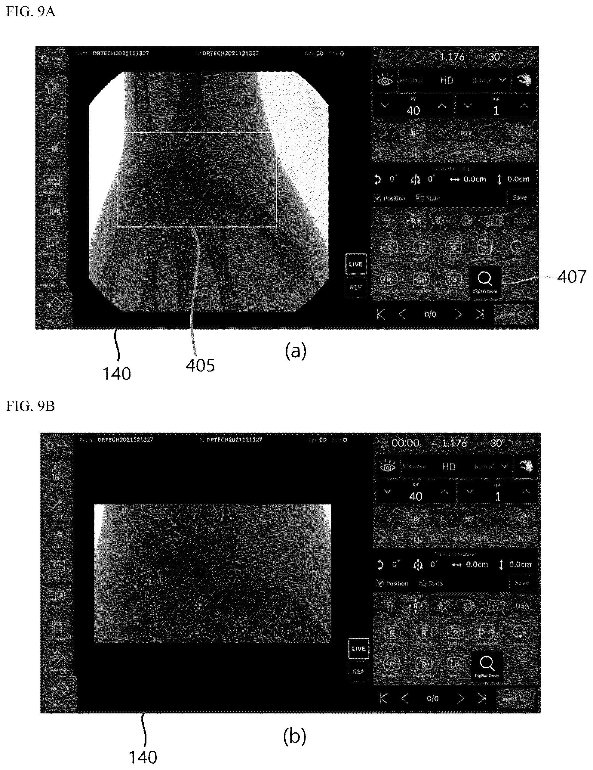 Patent US12564361 Figure 7 – Radiographic device and radiation flux control method