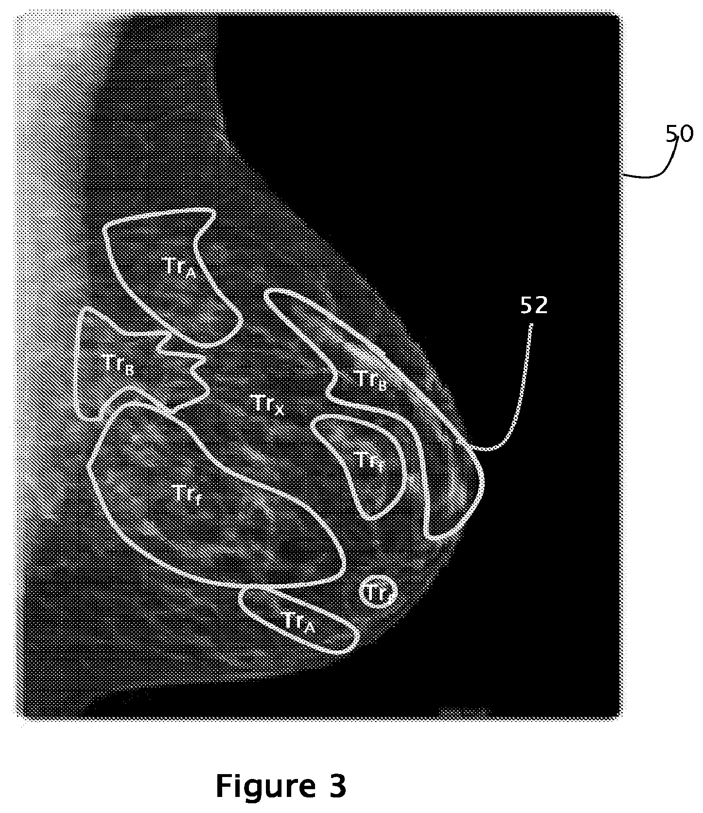 Patent US12564365 Figure 3 – System and method for generating and displaying tomosynthesis image slabs