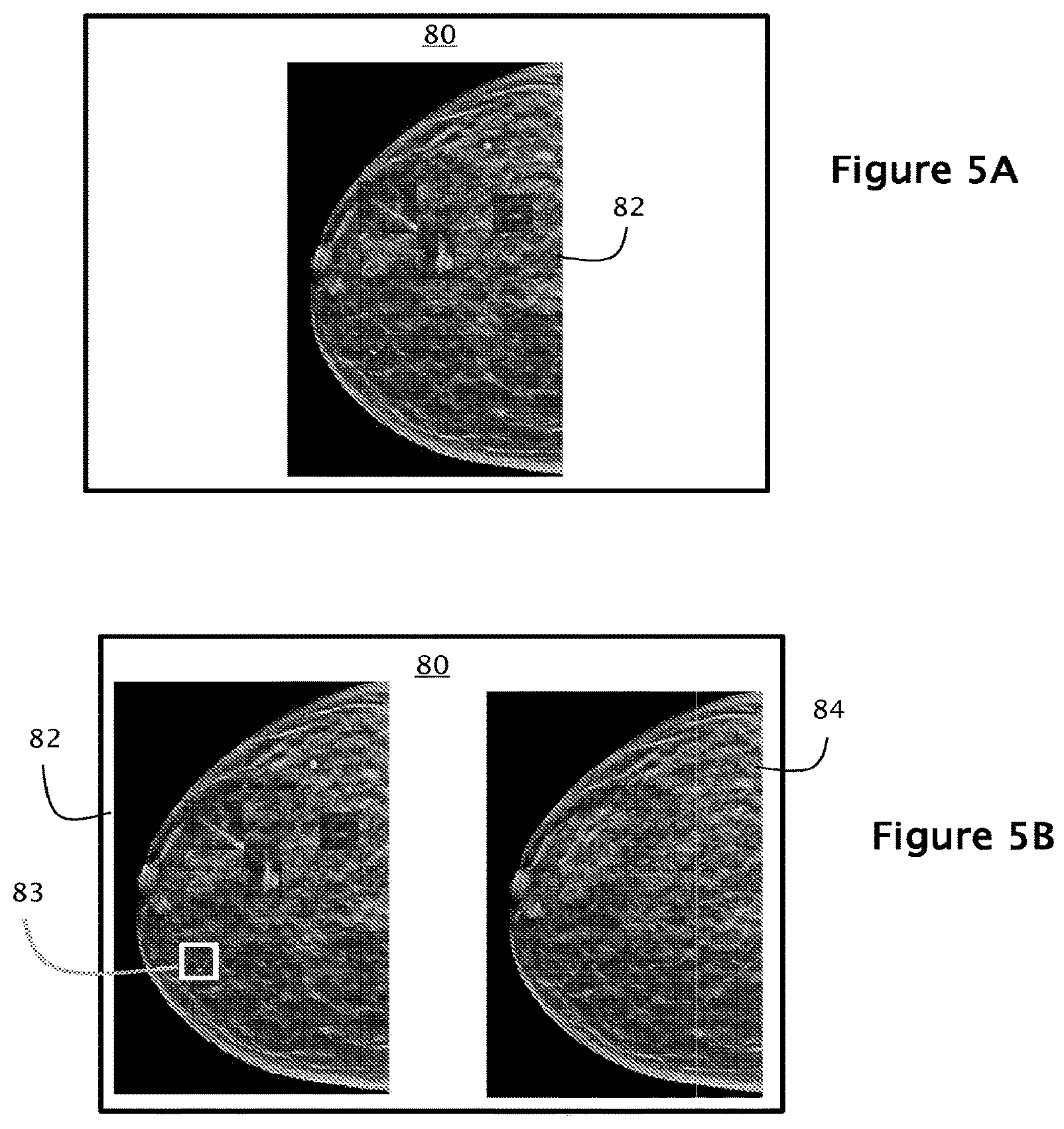 Patent US12564365 Figure 5 – System and method for generating and displaying tomosynthesis image slabs