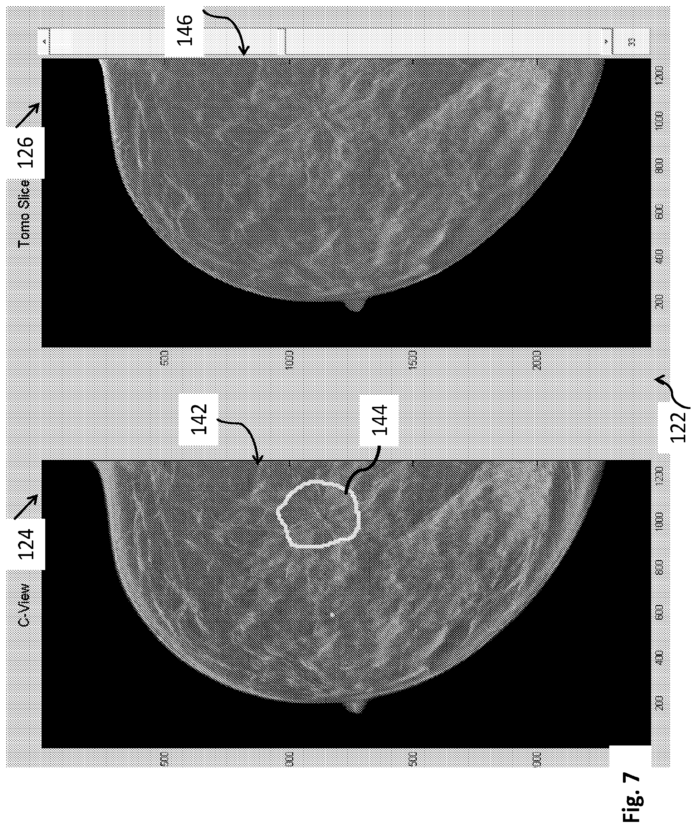 Patent US12564365 Figure 7 – System and method for generating and displaying tomosynthesis image slabs