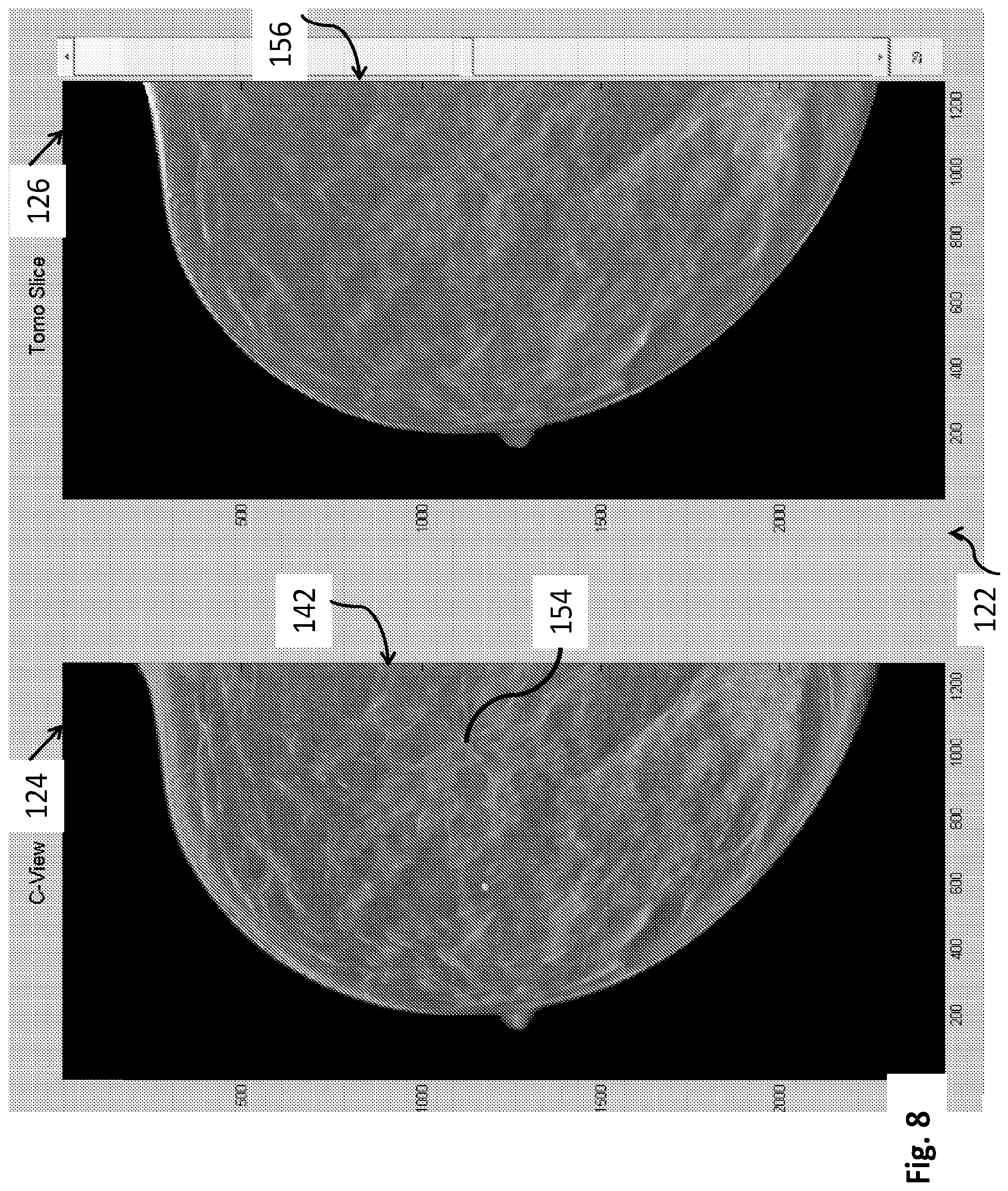 Patent US12564365 Figure 8 – System and method for generating and displaying tomosynthesis image slabs