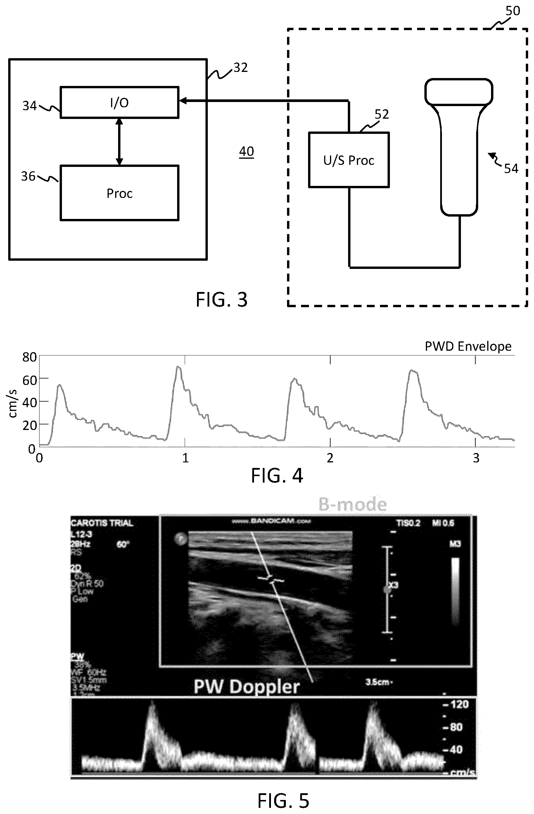 Patent US12564370 Figure 3 – Method for estimating hemodynamic parameters