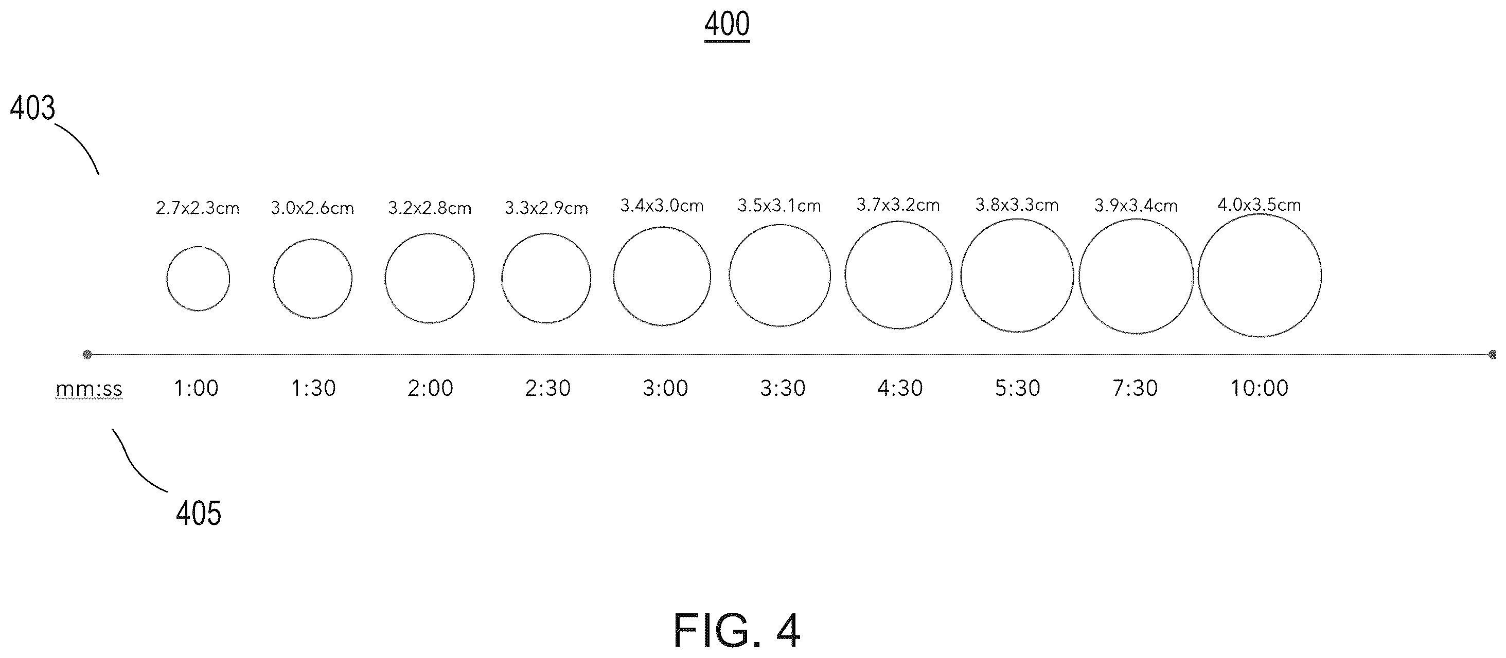 Patent US12564371 Figure 4 – System and method for displaying ablation zone progression