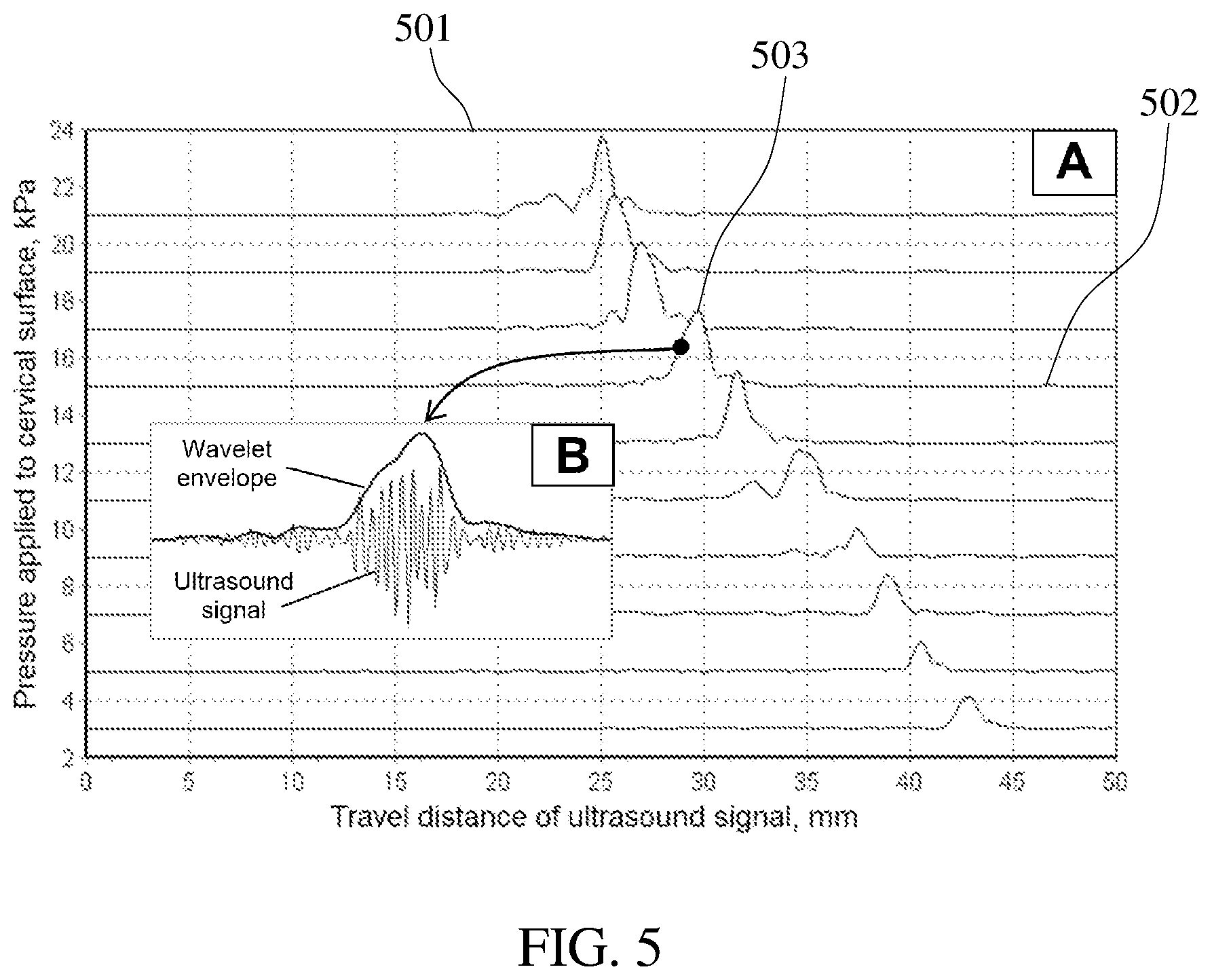Patent US12564372 Figure 5 – Tactile ultrasound method and probe for predicting preterm birth