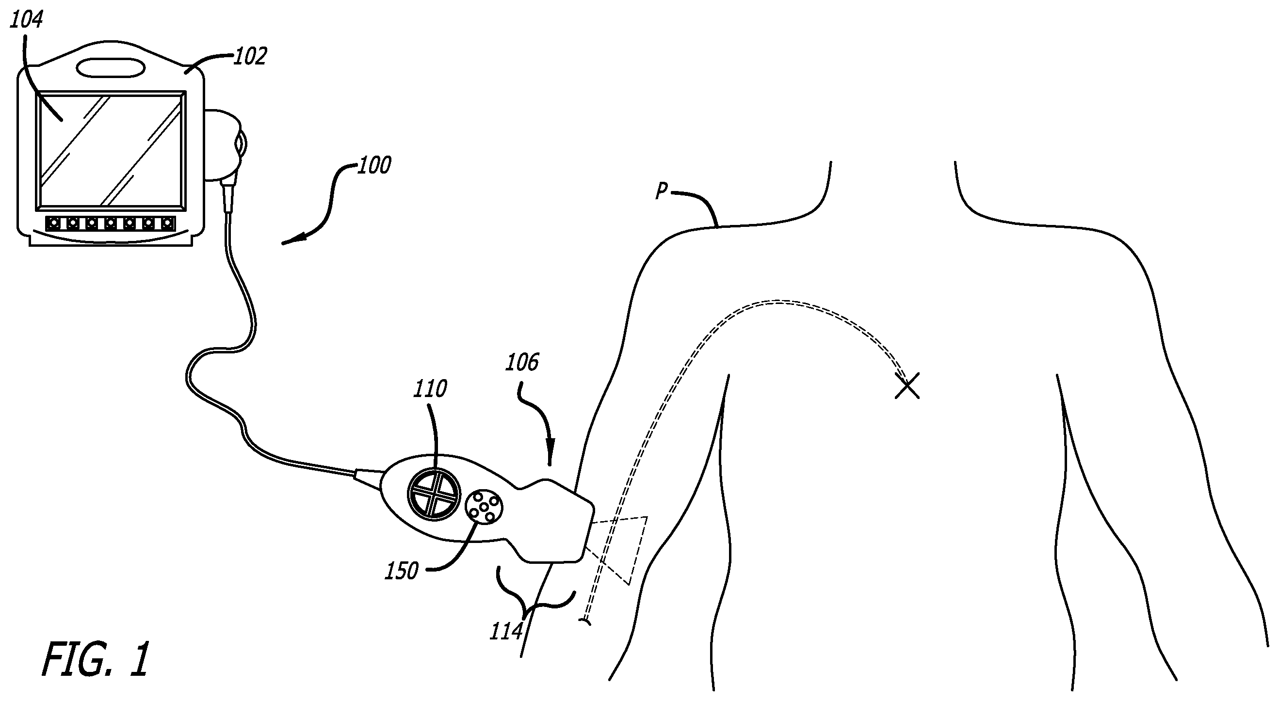 Patent US12564373 Figure 1 – Spatially aware medical device configured for performance of insertion pathway approximation