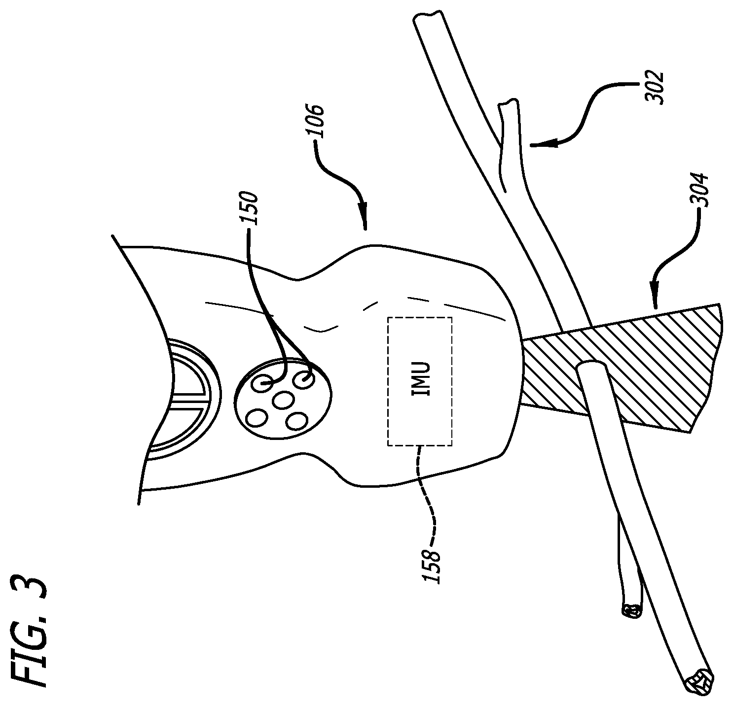 Patent US12564373 Figure 3 – Spatially aware medical device configured for performance of insertion pathway approximation