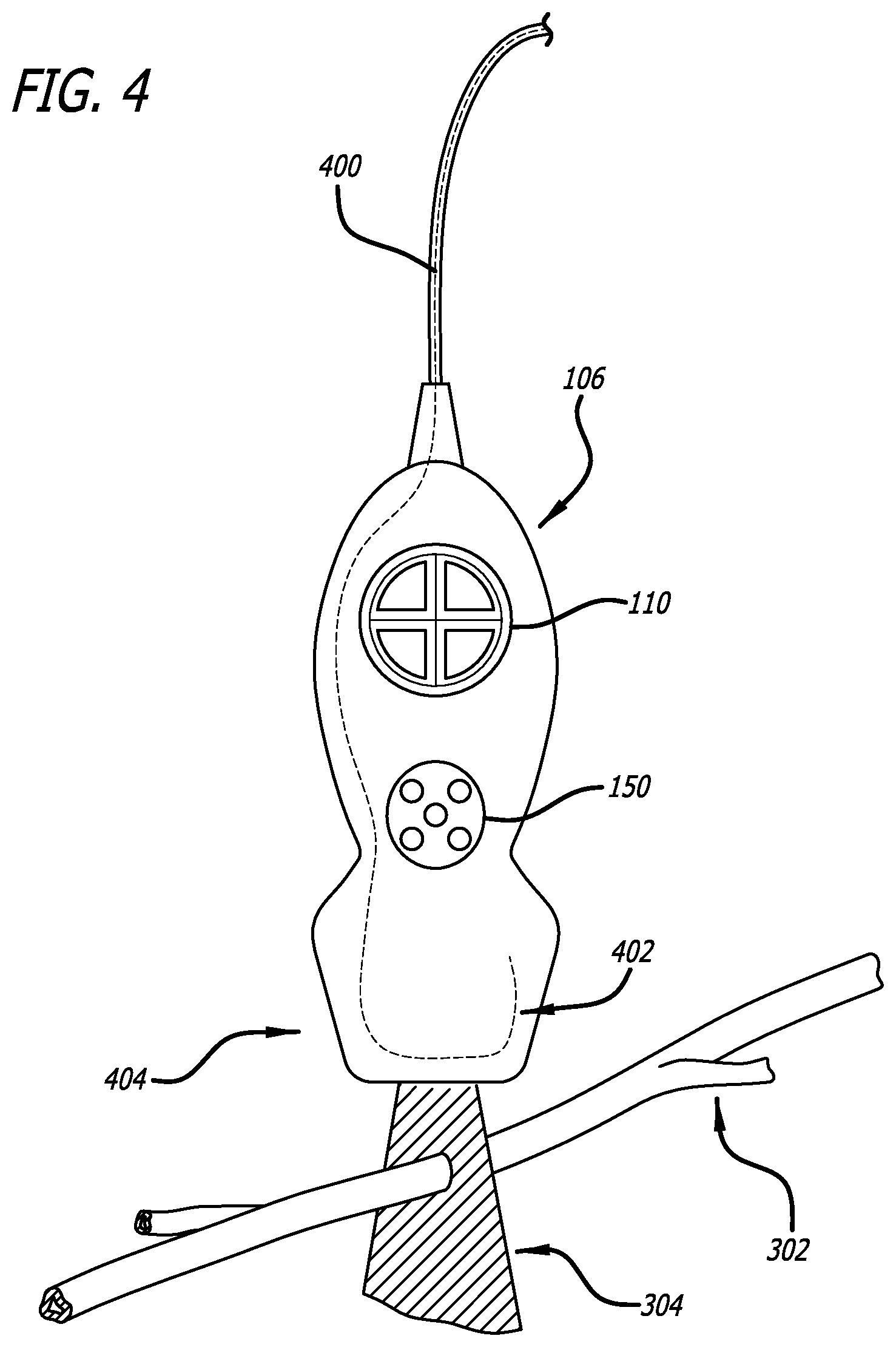 Patent US12564373 Figure 4 – Spatially aware medical device configured for performance of insertion pathway approximation