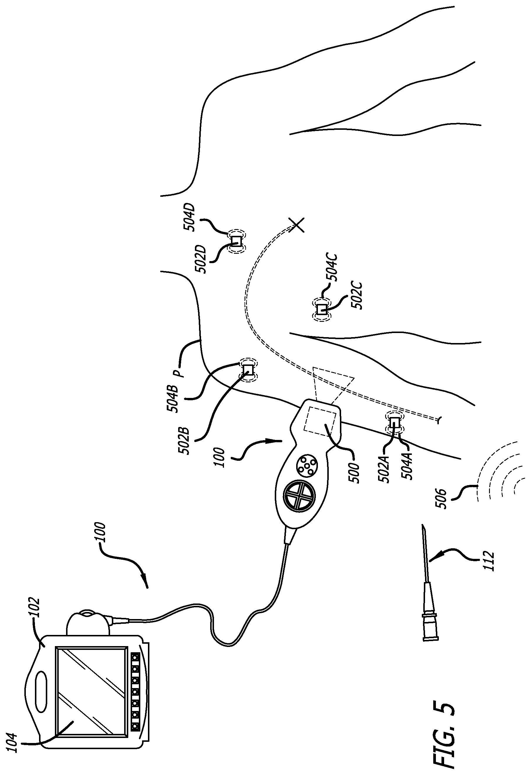 Patent US12564373 Figure 5 – Spatially aware medical device configured for performance of insertion pathway approximation