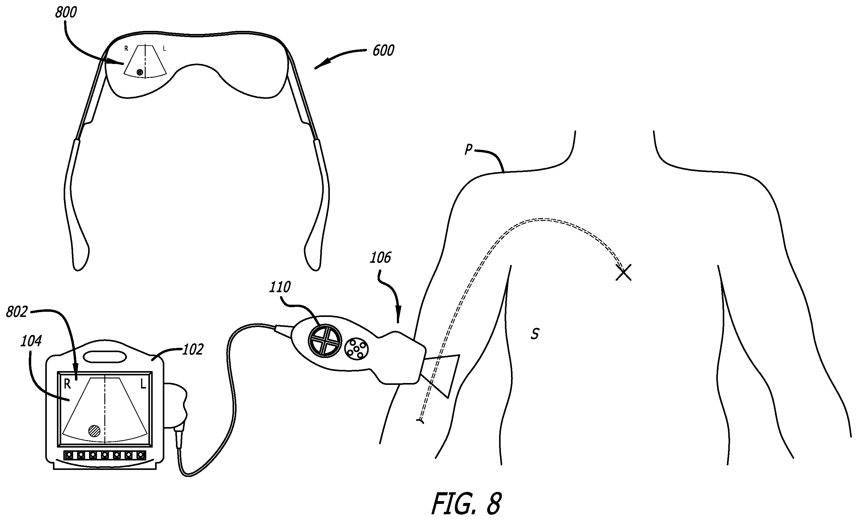 Patent US12564373 Figure 8 – Spatially aware medical device configured for performance of insertion pathway approximation