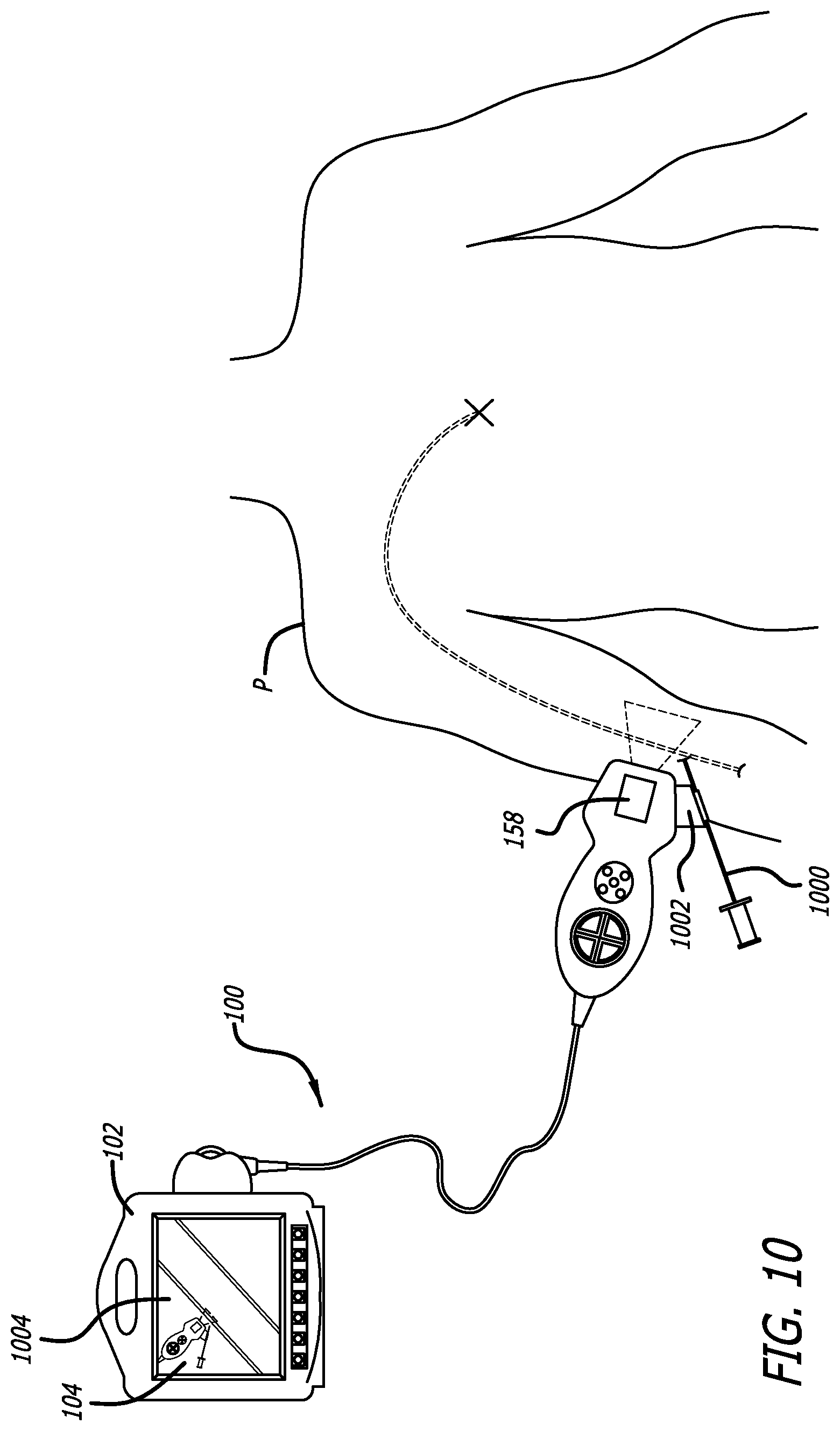 Patent US12564373 Figure 10 – Spatially aware medical device configured for performance of insertion pathway approximation