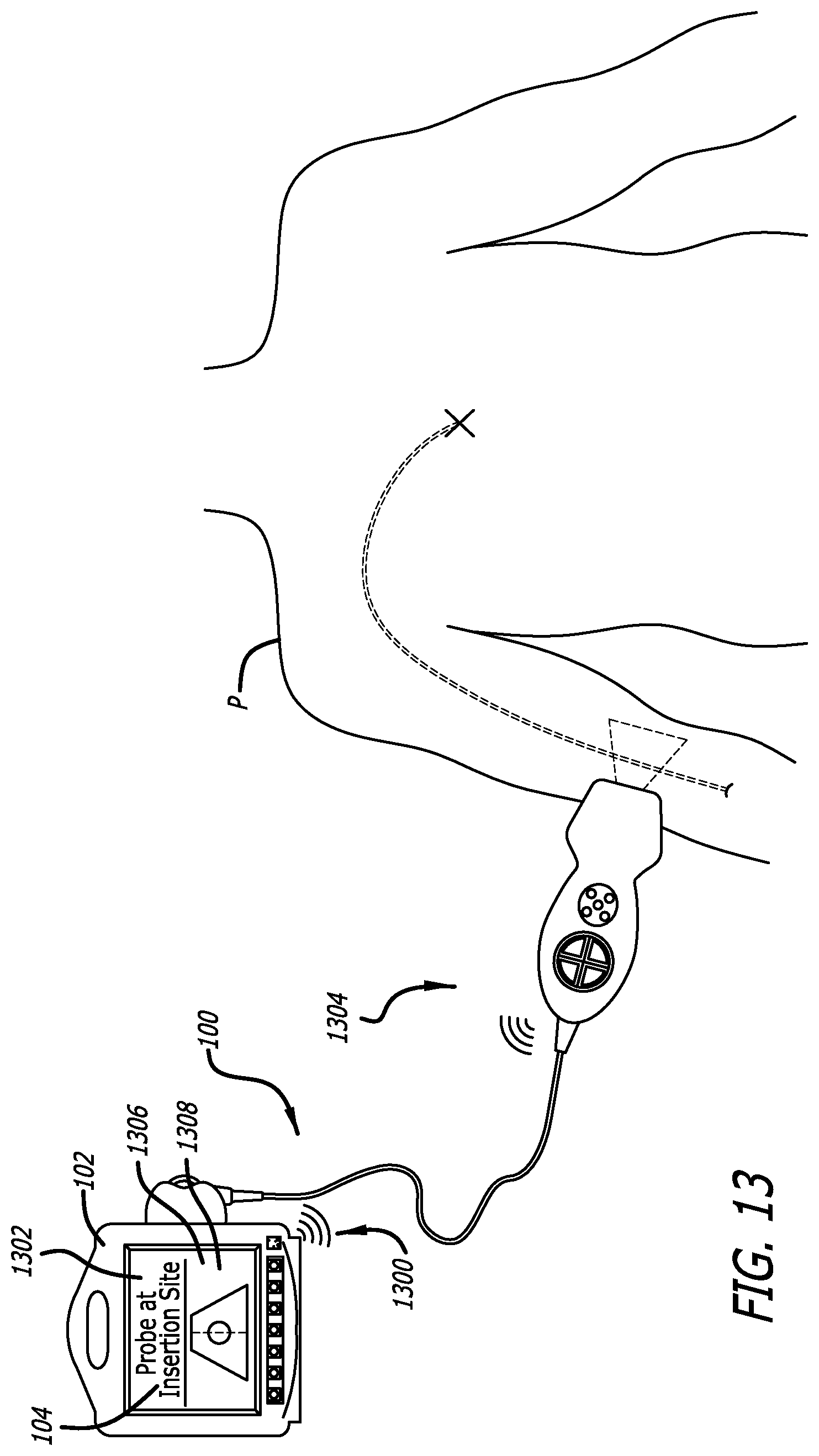 Patent US12564373 Figure 14 – Spatially aware medical device configured for performance of insertion pathway approximation