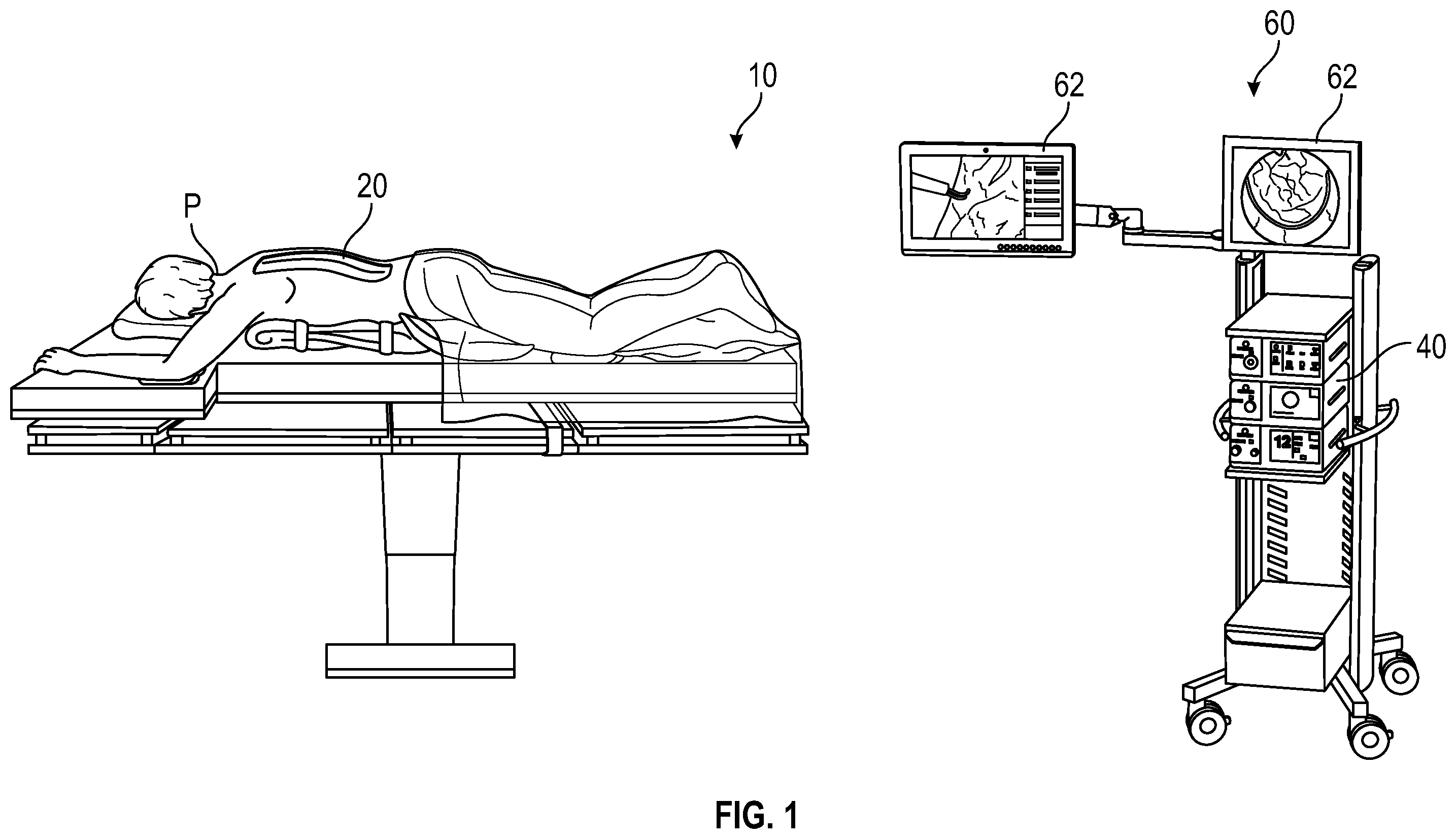 Patent US12564374 Figure 1 – Spinal cerebral artery rupture detector