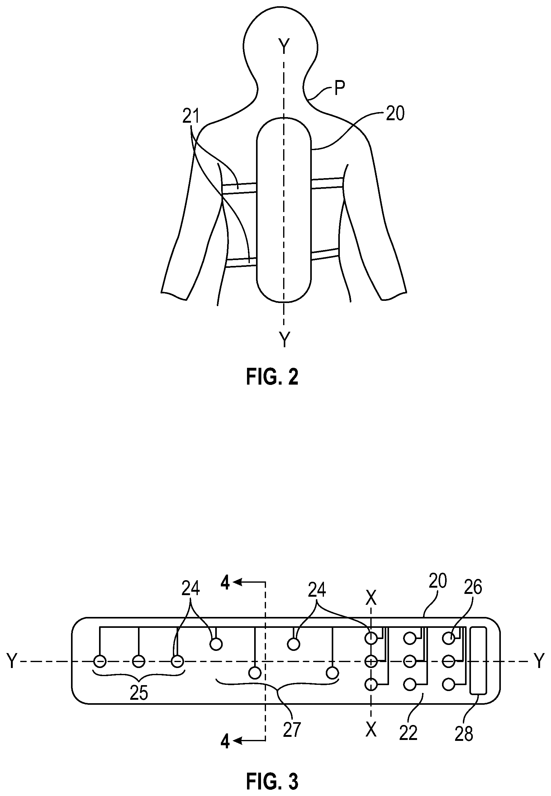 Patent US12564374 Figure 2 – Spinal cerebral artery rupture detector