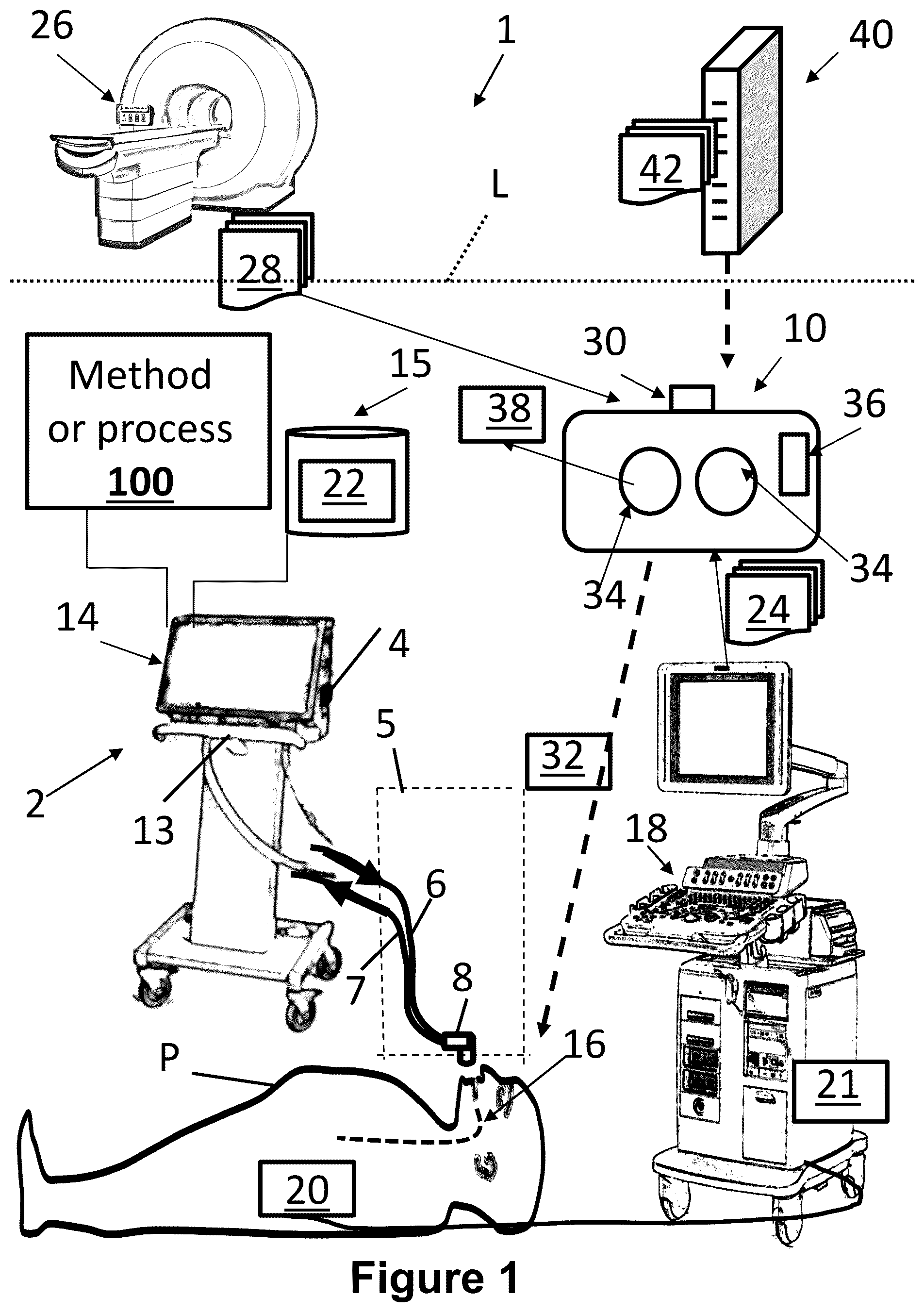 Patent US12564377 Figure 1 – Augmented reality for ultrasound exams at the point-of-care in combination with mechanical ventilation