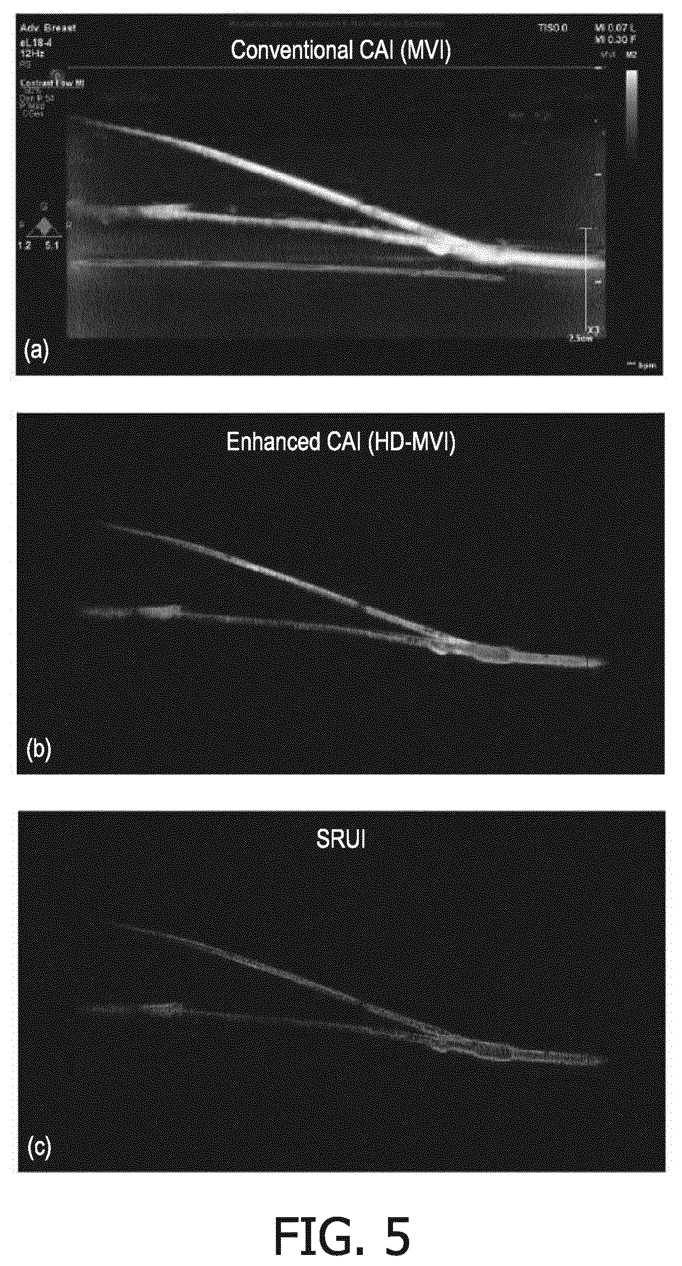 Patent US12564381 Figure 5 – Systems and methods for contrast enhanced imaging