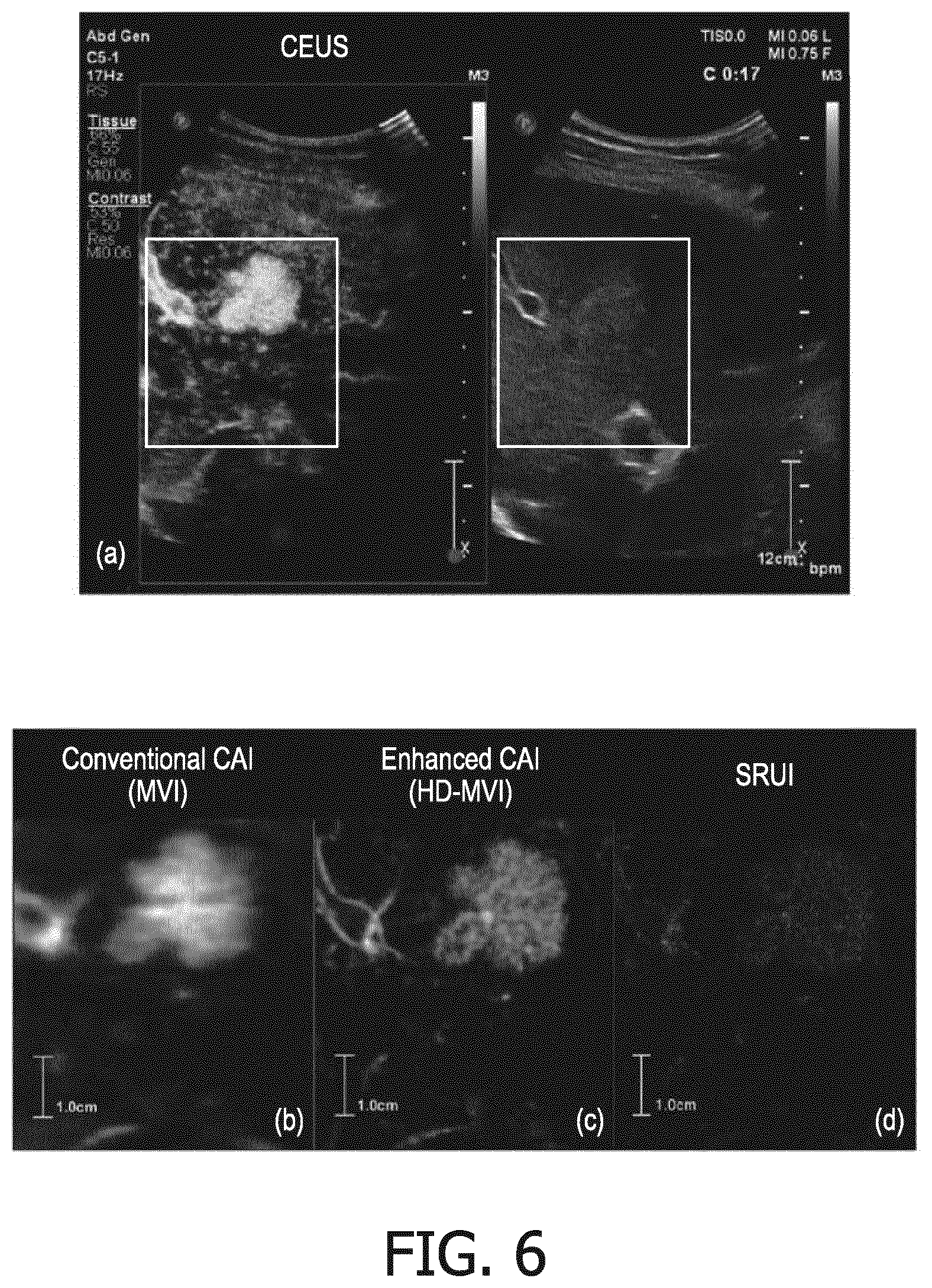 Patent US12564381 Figure 6 – Systems and methods for contrast enhanced imaging
